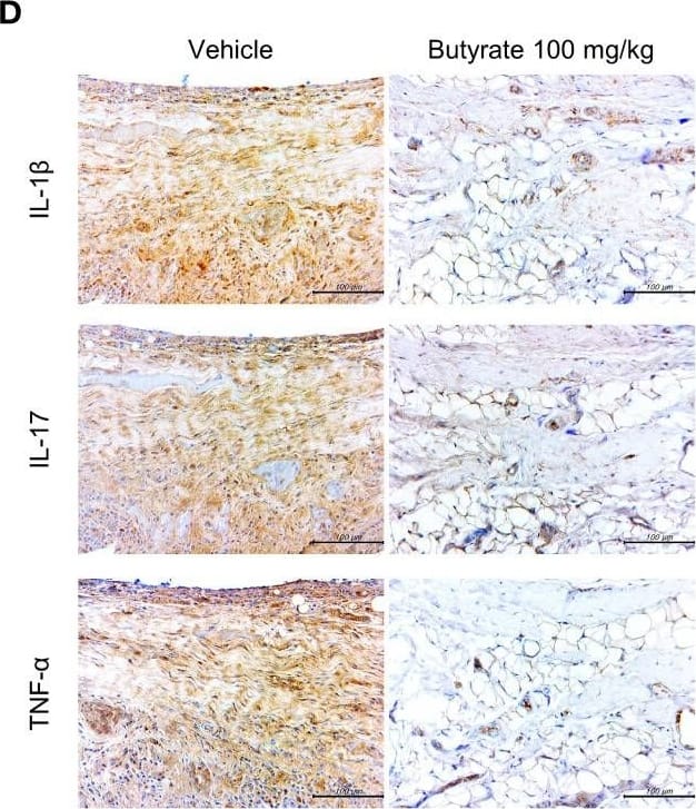 Effects of butyrate treatment on curdlan-induced SpA mice. SKG mice were injected with 3 mg of curdlan through intraperitoneal and oral administration. One week later, sodium butyrate (100 mg/kg) was administered orally once a day for 14 weeks. (A) Arthritis score and incidence were monitored by observation twice a week. (B, C) At 15 weeks post curdlan injection, joint and spine tissue samples were collected from all groups. Histopathology was evaluated for H&E and Safranin O staining. Inflammation, bone erosion, cartilage destruction, and nucleus pulposus (NP) and annulus fibrosus (AF) scores were assessed in both groups. (D) Synovial tissues in joints were immunohistochemically stained for IL-1 beta , IL-17, and TNF-alpha . Positive area (%) was analyzed with the color deconvolution tool in ImageJ. *P < 0.05, **P < 0.01, ***P < 0.001 and ****P < 0.0001. Image collected and cropped by CiteAb from the following open publication (//www.frontiersin.org/articles/10.3389/fimmu.2023.1096565/full), licensed under a CC-BY license. Not internally tested by Novus Biologicals.