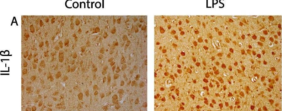 Representative photomicrographs showing immunohistochemical staining of IL-1 beta  (A), IBA-1 (B), GFAP (C), NeuN (D), caspase3 (E) and ApopTag (TUNEL, F) in the lateral gyrus. Arrowheads point to Caspase 3 + cells and arrows point to ApopTag (TUNEL +) cells. Scale bar = 100 μm Image collected and cropped by CiteAb from the following open publication (//pubmed.ncbi.nlm.nih.gov/37226206), licensed under a CC-BY license. Not internally tested by Novus Biologicals.