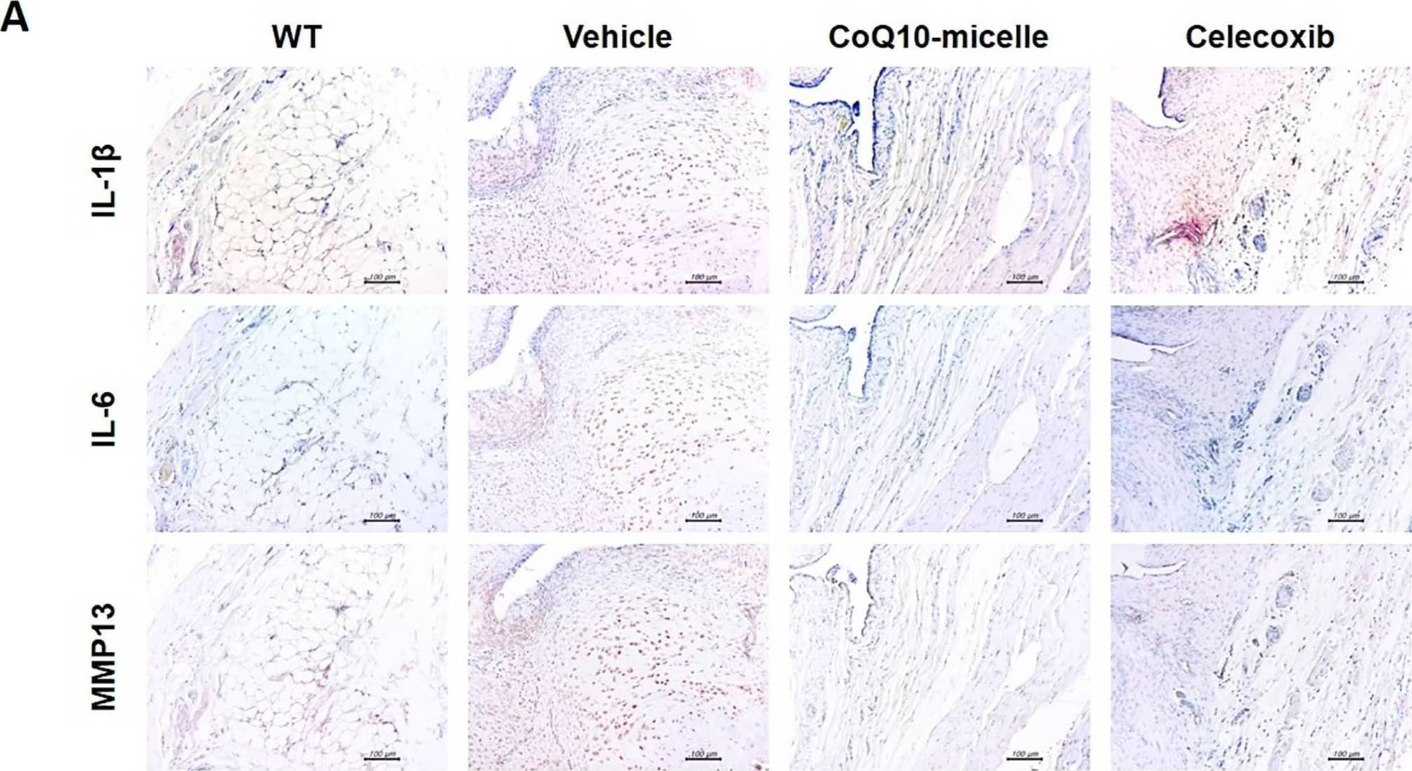 The anti-inflammatory effects of CoQ10-micelles during OA progression.(A) Representative images of immunohistochemical staining of IL-1 beta , IL-6, and MMP13 in the joint synovia of a WT group, a vehicle group, a CoQ10-micelle group, and a celecoxib group. (B) The bar graphs show the average positive areal percentages for IL-1 beta , IL-6, and MMP13. Data are shown as means +/- S.E.Ms. Statistical significance was assessed using the Bonferroni test. *p < 0.05. Image collected and cropped by CiteAb from the following open publication (//pubmed.ncbi.nlm.nih.gov/35749420), licensed under a CC-BY license. Not internally tested by Novus Biologicals.
