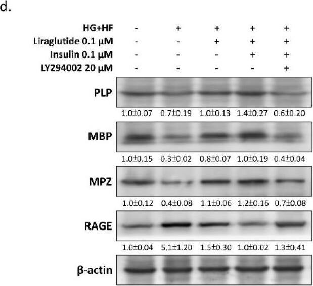 Liraglutide enhances the normal physiological function of SCs via insulin-Akt signaling. (a) Western blot analysis of Ser473-phosphorylated Akt confirmed that Liraglutide and insulin reverse the glucolipotoxicity-induced insulin signaling blockade. (b) MTT assays showed that the protective effect of Liraglutide and insulin were inhibited by co-treatment with 20 μM LY294002. (c) mRNA levels of neurotrophic factors, including CNTF, NGF, NT-3, and BDNF, were measured by qPCR. Liraglutide and insulin significantly elevated the mRNA levels of neurotrophic factors suppressed by glucolipotoxicity. However, LY294002 counteracted the effects of Liraglutide and insulin. (d) Western blots demonstrated that Liraglutide and insulin show efficacy in improving SC synthesis of essential myelin components and decrease the expression of the demyelination marker RAGE. Similarly, LY294002 blocked the effects of Liraglutide and insulin in promoting myelination in RSC96 SCs. All values are presented as the mean +/- SEM. Significant difference was determined using multiple comparisons of Dunnett’s posthoc test for * p < 0.05 and ** p < 0.01. N.S., not significant. Image collected and cropped by CiteAb from the following open publication (//pubmed.ncbi.nlm.nih.gov/36291547), licensed under a CC-BY license. Not internally tested by Novus Biologicals.