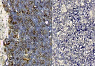 Immunohistochemistry of Transferrin Antibody. Tissue: Proliferant, cycling human thymus. Antigen Retrieval: HIER pH6.2. Staining: diffuse cytoplasmic and membrane staining. Right: Transferrin antibody 209-4134 at 1:100. Left: Normal Rabbit IgG Neg Ctrl.