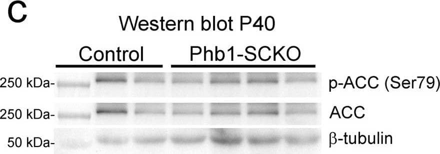 Western Blot: beta Tubulin Antibody - BSA Free [NB600-936] - Deletion of Phb1 affects lipid metabolism.Western blot (a) & quantification (b) of Acetyl-CoA carboxylase (ACC) & phosphorylated ACC (p-ACC) expression at P20. N = 6–7 animals per genotype. Unpaired two-tailed t-test [p-ACC (t = 0.4627, df = 11, p = 0.021), ACC (t = 1.355, df = 11, p = 0.26)]. Western blot (c) & quantification (d) of ACC & p-ACC expression at P40. N = 6–8 animals per genotype [p-ACC (t = 0.5447, df = 12, p = 0.42), ACC (t = 1.153, df = 12, p = 0.17)]. Unpaired two-tailed t-test. By RT-qPCR, we identified a significant downregulation of many enzymes involved with lipid biosynthesis at both P20 (e) & P40 (f): sterol regulatory element-binding protein 1 (Srebp1), 3-hydroxy-3-methylglutaryl-CoA reductase (Hmgcr), ATP citrate lyase (Acly), fatty acid synthase (FASN), acetyl-CoA carboxylase 2 (ACC2), N = 5 animals per genotype. Unpaired two-tailed t-test P20 [Srebp1 (t = 3.26, df = 8, p = 0.012), Hmgcr (t = 7.63, df = 8, p = 0.000061), Acly (t = 4.418, df = 8, 0.0022), FASN (t = 4.109, df = 8, p = 0.0034), ACC2 (t = 3.408, df = 8, p = 0.0092)]; P40 [Srebp1 (t = 7.551, df = 8, p = 0.000066), Hmgcr (t = 5.091, df = 8, p = 0.00094), Acly (t = 4.934, df = 8, p = 0.0011), FASN (t = 7.186, df = 8, p = 0.000094), ACC2 (t = 2.697, df = 8, p = 0.027)]. Data are presented as mean ± SEM. *p < 0.05; **p < 0.01; ***p < 0.001. n.s. non-significant. Image collected & cropped by CiteAb from the following publication (//pubmed.ncbi.nlm.nih.gov/34078899), licensed under a CC-BY license. Not internally tested by Novus Biologicals.