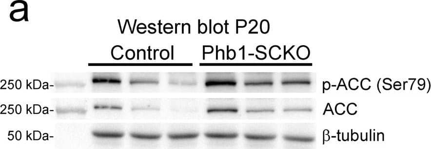 Western Blot: beta Tubulin Antibody - BSA Free [NB600-936] - Deletion of Phb1 affects lipid metabolism.Western blot (a) & quantification (b) of Acetyl-CoA carboxylase (ACC) & phosphorylated ACC (p-ACC) expression at P20. N = 6–7 animals per genotype. Unpaired two-tailed t-test [p-ACC (t = 0.4627, df = 11, p = 0.021), ACC (t = 1.355, df = 11, p = 0.26)]. Western blot (c) & quantification (d) of ACC & p-ACC expression at P40. N = 6–8 animals per genotype [p-ACC (t = 0.5447, df = 12, p = 0.42), ACC (t = 1.153, df = 12, p = 0.17)]. Unpaired two-tailed t-test. By RT-qPCR, we identified a significant downregulation of many enzymes involved with lipid biosynthesis at both P20 (e) & P40 (f): sterol regulatory element-binding protein 1 (Srebp1), 3-hydroxy-3-methylglutaryl-CoA reductase (Hmgcr), ATP citrate lyase (Acly), fatty acid synthase (FASN), acetyl-CoA carboxylase 2 (ACC2), N = 5 animals per genotype. Unpaired two-tailed t-test P20 [Srebp1 (t = 3.26, df = 8, p = 0.012), Hmgcr (t = 7.63, df = 8, p = 0.000061), Acly (t = 4.418, df = 8, 0.0022), FASN (t = 4.109, df = 8, p = 0.0034), ACC2 (t = 3.408, df = 8, p = 0.0092)]; P40 [Srebp1 (t = 7.551, df = 8, p = 0.000066), Hmgcr (t = 5.091, df = 8, p = 0.00094), Acly (t = 4.934, df = 8, p = 0.0011), FASN (t = 7.186, df = 8, p = 0.000094), ACC2 (t = 2.697, df = 8, p = 0.027)]. Data are presented as mean ± SEM. *p < 0.05; **p < 0.01; ***p < 0.001. n.s. non-significant. Image collected & cropped by CiteAb from the following publication (//pubmed.ncbi.nlm.nih.gov/34078899), licensed under a CC-BY license. Not internally tested by Novus Biologicals.