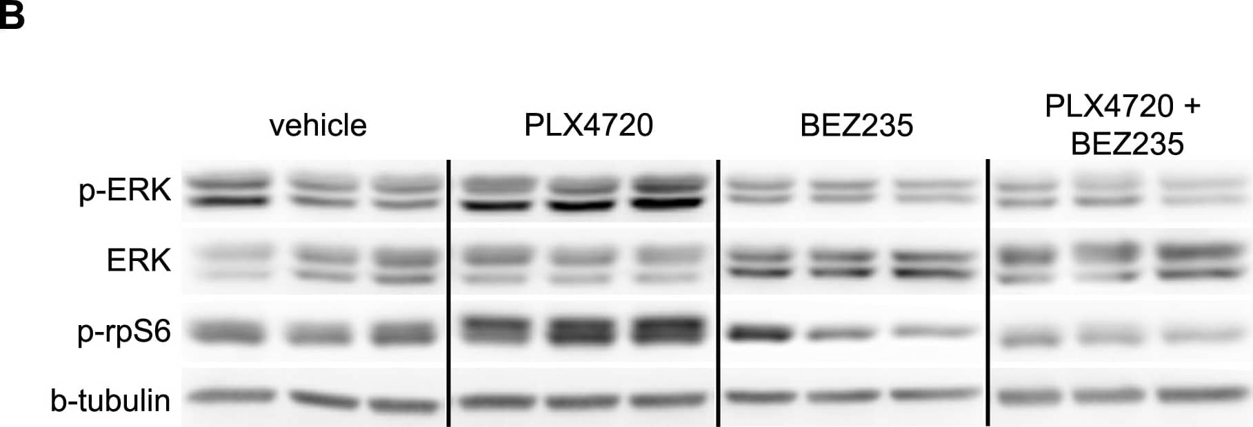 Western Blot: beta Tubulin Antibody - BSA Free [NB600-936] - [18F]-FLT PET reflects BEZ235-dependent inhibition of PI3K/mTOR activity in PLX4720 treated COLO 205 xenografts. Xenograft-bearing mice were imaged with [18F]-FLT PET on treatment day 4. (A) [18F]-FLT uptake was diminished in the combination treatment cohort relative to vehicle (p = 0.0087), but not single agent PLX4720- or BEZ235-treated cohorts. (B) Western blot of xenograft tissue harvested immediately following imaging illustrated elevated p-ERK & p-rpS6 levels in PLX4720-treated mice. Combining PLX4032 with BEZ235 resulted in reduced p-ERK & p-rpS6 protein levels. (C) TK1 levels, as measured by IHC, were reduced only in the combination treatment group in agreement with [18F]-FLT PET. (D) Consistent with in vitro studies, diminished TK1 levels, & consequently [18F]-FLT PET, correlated with elevated p27 that was elevated only in the combination treated group. Image collected & cropped by CiteAb from the following publication (//pubmed.ncbi.nlm.nih.gov/25247710), licensed under a CC-BY license. Not internally tested by Novus Biologicals.