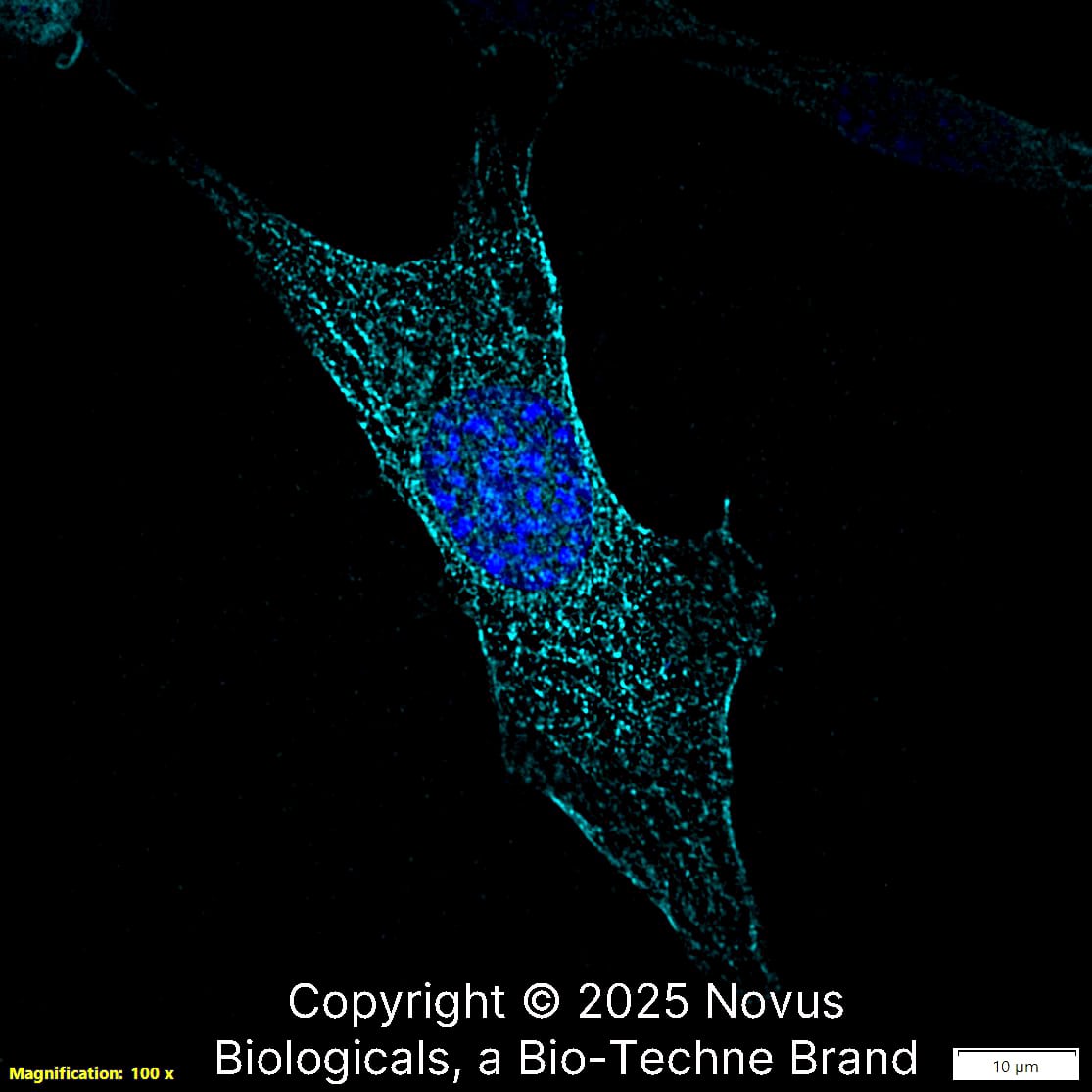 Beta Tubulin was detected in immersion fixed NIH-3T3 Mouse fibroblast cell line using Rabbit anti-beta Tubulin Affinity Purified Polyclonal Antibody conjugated to Alexa Fluor® 647 (Catalog # NB600-936AF647) (light blue) at 2 µg/mL overnight at 4C. Cells were counterstained with DAPI (blue). Cells were imaged using a 100X objective and digitally deconvolved.  