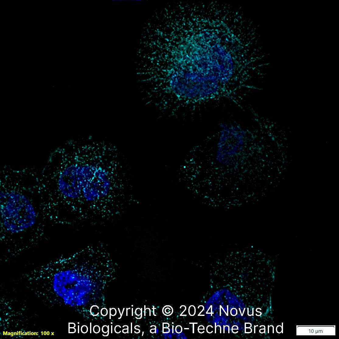 Beta Tubulin was detected in immersion fixed A431 human skin carcinoma cell line using Rabbit anti-beta Tubulin Affinity Purified Polyclonal Antibody conjugated to Alexa Fluor® 647 (Catalog # NB600-936AF647) (light blue) at 5 µg/mL overnight at 4C. Cells were counterstained with DAPI (blue). Cells were imaged using a 100X objective and digitally deconvolved.  