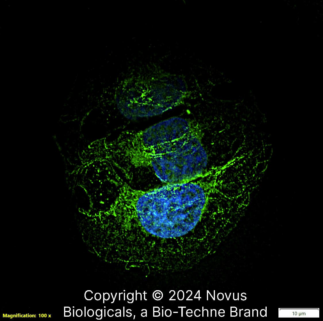 Beta Tubulin was detected in immersion fixed U-2 OS human osteosarcoma cell line using Rabbit anti-beta Tubulin Affinity Purified Polyclonal Antibody conjugated to DyLight 488 (Catalog # NB600-936G) (green) at 5 µg/mL overnight at 4C. Cells were counterstained with DAPI (blue). Cells were imaged using a 100X objective and digitally deconvolved.