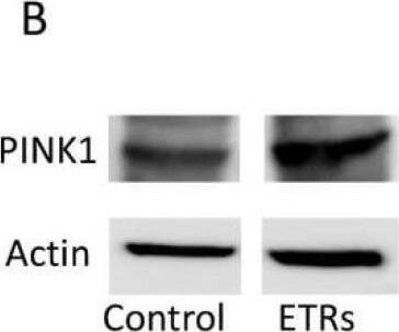 Overexpression of PINK1 in SCs of ETRs indicating mitochondrial damage. (A) IHC of PINK1. Note the perinuclear localization of PINK1 (arrows). The broken arrows indicate SC nuclei. The inset shows magnified SC nuclei; (B,C) Western blot analysis of PINK1. The relative expression level for protein was normalized to actin and expressed as fold change relative to the control (n = 3). Image collected and cropped by CiteAb from the following open publication (//pubmed.ncbi.nlm.nih.gov/30621351), licensed under a CC-BY license. Not internally tested by Novus Biologicals.