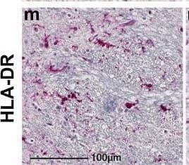 Prominent neuroinflammation in brain of SARS-CoV-2 infected NHPs.Representative images identify microglia through Iba-1 immunopositivity in basal ganglia of mock-infected animals RM6 and AGM5 (a, c) that was upregulated in SARS-CoV-2 infected parenchyma, as shown in RM2 and AGM4 (b, d). Mild-moderate accumulation of microglia was often observed around blood vessels (RM1 f, AGM1 h). Nodular lesions were also frequently observed in brain of infected animals, represented here in RM4 and AGM4 (j, l). Microglial accumulation around blood vessels was not seen in age-matched mock-infected controls (RM6 e, AGM5 g), however, nodules (RM5 i, AGM5 k) were seen. These were less frequent and smaller than those observed in infection. Iba-1 immunopositivity also revealed morphological changes in microglia indicative of increased activation in infected animals, as compared to mock-infected controls, including large cell bodies with short, thickened processes (b, d, f, h, j, l). Microglial expression of HLA-DR was upregulated in the context of infection (n, p) seen in RM2 and AGM2, however, expression was also seen in control animals (m, o) represented by RM6 and AGM5. GFAP expression by astrocytes is upregulated and reveals morphological changes in the context of infection (cerebellum from RM4 r, AGM2 t), indicative of astrogliosis. Cerebellum from non-infected controls RM6 and AGM5 (q, s). Each immunohistochemical stain was performed twice on all brain regions. Abbreviations: AGM African green monkey, RM Rhesus macaque. Scale bars = 100 um (a–d, m–t) and 50 um (e–l). Image collected and cropped by CiteAb from the following open publication (//pubmed.ncbi.nlm.nih.gov/35365631), licensed under a CC-BY license. Not internally tested by Novus Biologicals.