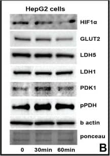 Western Blot: Rabbit anti-Mouse IgG (H+L) Secondary Antibody [Biotin] [NB720-B] - (A) Confocal microscopy of NCTC liver cells before & after exposure to amifostine (100 μg/ml), for double PDH(red)/phosphoPDH(green), phosphoPDH(red), LDH5 (red) & HIF1 alpha  (red) expression. Western blot bands following exposure to 100 & 500 μg/ml of amifostine at 30 min is also shown. (B) Western blot expression of phosphoPDH, PDK1, LDH5 & HIF1 alpha  in hepatoma HepG2 cells, at 0, 30 & 60 min following exposure to 100 μg/ml of amifostine. (C) Confocal microscopy of NCTC liver cells before & after exposure to amifostine (100 μg/ml), for HIF1 alpha  (green), LDH5 (red), PDK1 (green) & phosphoPDH(red) expression with & without silencing of the HIF1 alpha  gene. (D) Acetyl-CoA levels (pmol) in NCTC cells at 0, 30 & 60 min following exposure to 100 μg/ml of amifostine. (E) ATP levels (pmol) in NCTC cells at 0, 30 & 60 min following exposure to 100 μg/ml of amifostine. (F) Time course recording of NCTC & HepG2 cell mitochondrial membrane potentials as assessed with the JC1 method & confocal imaging (0–20 minutes), showed a rapid transient reduction of green (monomer) & red (aggregate) forms of the dye that was subsequently restored to normal levels. (G) Mitochondrial ROS (mtROS) production by NCTC & HepG2 cells, after exposure to 18Gy of ionizing radiation with & without pre-incubation with amifostine, showing a strong effect of amifostine in normal NCTC cells. mtROS were low in hepatoma HepG2 cells compared to NCTC hepatocytes & were increased only in dividing neoplastic cells. Image collected & cropped by CiteAb from the following publication (//pubmed.ncbi.nlm.nih.gov/27507219), licensed under a CC-BY license. Not internally tested by Novus Biologicals.