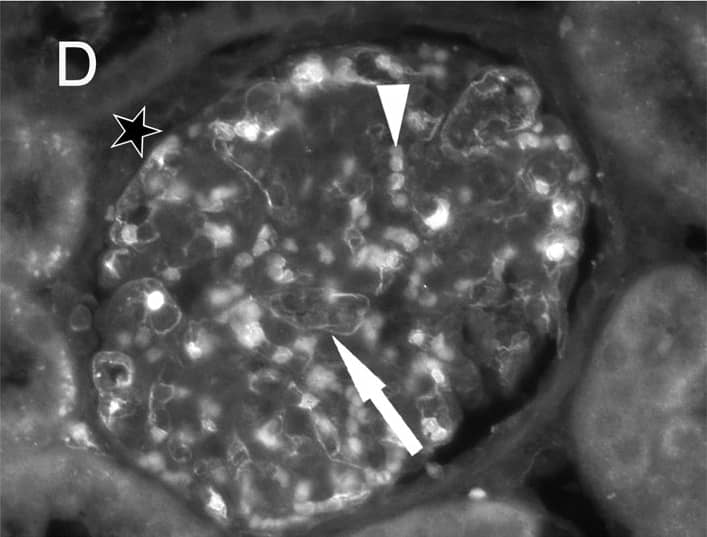 Immunohistochemistry: Goat anti-Human IgG Fc Secondary Antibody [NB7446] - Immune fluorescent photomicrographs of glomeruli from control (A), aflibercept-treated (B–D) & ranibizumab-treated (E–F) monkeys eyes.In all figures, the asterisks label the spaces of the Bowman capsule. A) Kidney sections from the control animal did not show any specific staining with anti-human IgG-Fc antibody in the glomeruli. Only the erythrocytes (arrow) within the capillaries showed a weak fluorescence. B) One day after aflibercept injection, the endothelium cell layer & material within the capillaries of a glomerulus were highly fluorescent (white arrow) after labelling with an antibody against the Fc region of IgG. In an adjacent glomerulus, only the endothelium was stained (white arrowhead) whereas the lumina of the vessels did not contain IgG-Fc positive material (black arrow). C) Erythrocytes within the glomeruli (arrowhead) as well as the endothelium (arrow) were highly fluorescent. D) Seven days after aflibercept injection, the fluorescent material within the capillaries (arrowhead) & the fluorescence intensity of the endothelium became weaker. E) One day after ranibizumab injection, the endothelium cell layer (white arrow) & erythrocytes (arrowhead & black arrow in the inset) were fluorescent after staining with an antibody against human Fab of IgG. F) The specific fluorescence of the endothelium (arrow) & erythrocytes (arrowhead) was nearly lost seven days after injection of ranibizumab. Image collected & cropped by CiteAb from the following publication (//pubmed.ncbi.nlm.nih.gov/25415380), licensed under a CC-BY license. Not internally tested by Novus Biologicals.