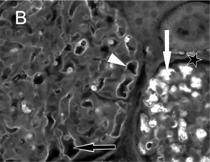 Immunohistochemistry: Goat anti-Human IgG Fc Secondary Antibody [NB7446] - Immune fluorescent photomicrographs of glomeruli from control (A), aflibercept-treated (B–D) & ranibizumab-treated (E–F) monkeys eyes.In all figures, the asterisks label the spaces of the Bowman capsule. A) Kidney sections from the control animal did not show any specific staining with anti-human IgG-Fc antibody in the glomeruli. Only the erythrocytes (arrow) within the capillaries showed a weak fluorescence. B) One day after aflibercept injection, the endothelium cell layer & material within the capillaries of a glomerulus were highly fluorescent (white arrow) after labelling with an antibody against the Fc region of IgG. In an adjacent glomerulus, only the endothelium was stained (white arrowhead) whereas the lumina of the vessels did not contain IgG-Fc positive material (black arrow). C) Erythrocytes within the glomeruli (arrowhead) as well as the endothelium (arrow) were highly fluorescent. D) Seven days after aflibercept injection, the fluorescent material within the capillaries (arrowhead) & the fluorescence intensity of the endothelium became weaker. E) One day after ranibizumab injection, the endothelium cell layer (white arrow) & erythrocytes (arrowhead & black arrow in the inset) were fluorescent after staining with an antibody against human Fab of IgG. F) The specific fluorescence of the endothelium (arrow) & erythrocytes (arrowhead) was nearly lost seven days after injection of ranibizumab. Image collected & cropped by CiteAb from the following publication (//pubmed.ncbi.nlm.nih.gov/25415380), licensed under a CC-BY license. Not internally tested by Novus Biologicals.