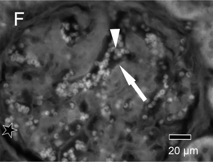 Immunohistochemistry: Goat anti-Human IgG Fc Secondary Antibody [NB7446] - Immune fluorescent photomicrographs of glomeruli from control (A), aflibercept-treated (B–D) & ranibizumab-treated (E–F) monkeys eyes.In all figures, the asterisks label the spaces of the Bowman capsule. A) Kidney sections from the control animal did not show any specific staining with anti-human IgG-Fc antibody in the glomeruli. Only the erythrocytes (arrow) within the capillaries showed a weak fluorescence. B) One day after aflibercept injection, the endothelium cell layer & material within the capillaries of a glomerulus were highly fluorescent (white arrow) after labelling with an antibody against the Fc region of IgG. In an adjacent glomerulus, only the endothelium was stained (white arrowhead) whereas the lumina of the vessels did not contain IgG-Fc positive material (black arrow). C) Erythrocytes within the glomeruli (arrowhead) as well as the endothelium (arrow) were highly fluorescent. D) Seven days after aflibercept injection, the fluorescent material within the capillaries (arrowhead) & the fluorescence intensity of the endothelium became weaker. E) One day after ranibizumab injection, the endothelium cell layer (white arrow) & erythrocytes (arrowhead & black arrow in the inset) were fluorescent after staining with an antibody against human Fab of IgG. F) The specific fluorescence of the endothelium (arrow) & erythrocytes (arrowhead) was nearly lost seven days after injection of ranibizumab. Image collected & cropped by CiteAb from the following publication (//pubmed.ncbi.nlm.nih.gov/25415380), licensed under a CC-BY license. Not internally tested by Novus Biologicals.