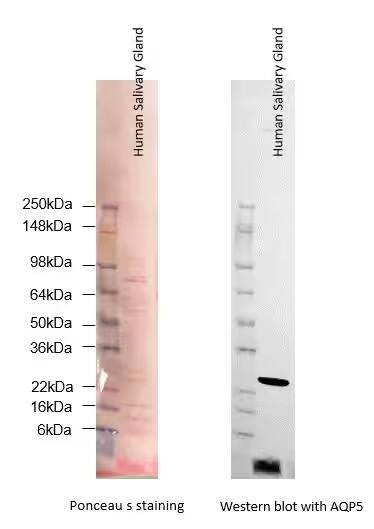 Western Blot: Human Salivary Gland Whole Tissue Lysate (Adult Whole Normal) [NB820-59251] - Human Salivary Gland Whole Tissue Lysate (Adult Whole Normal, 30ug) was blotted with AQP5 antibody by Western Blot. Image from a verified customer review.