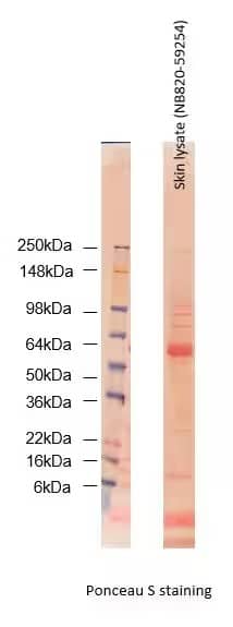 Western Blot: Human Skin Whole Tissue Lysate (Adult Whole Normal) [NB820-59254] - Human skin Whole Tissue Lysate (Adult Whole Normal) 30ug/lane was loaded to SDS-PAGE gel and transferred to a membrane. Image from a verified customer review.