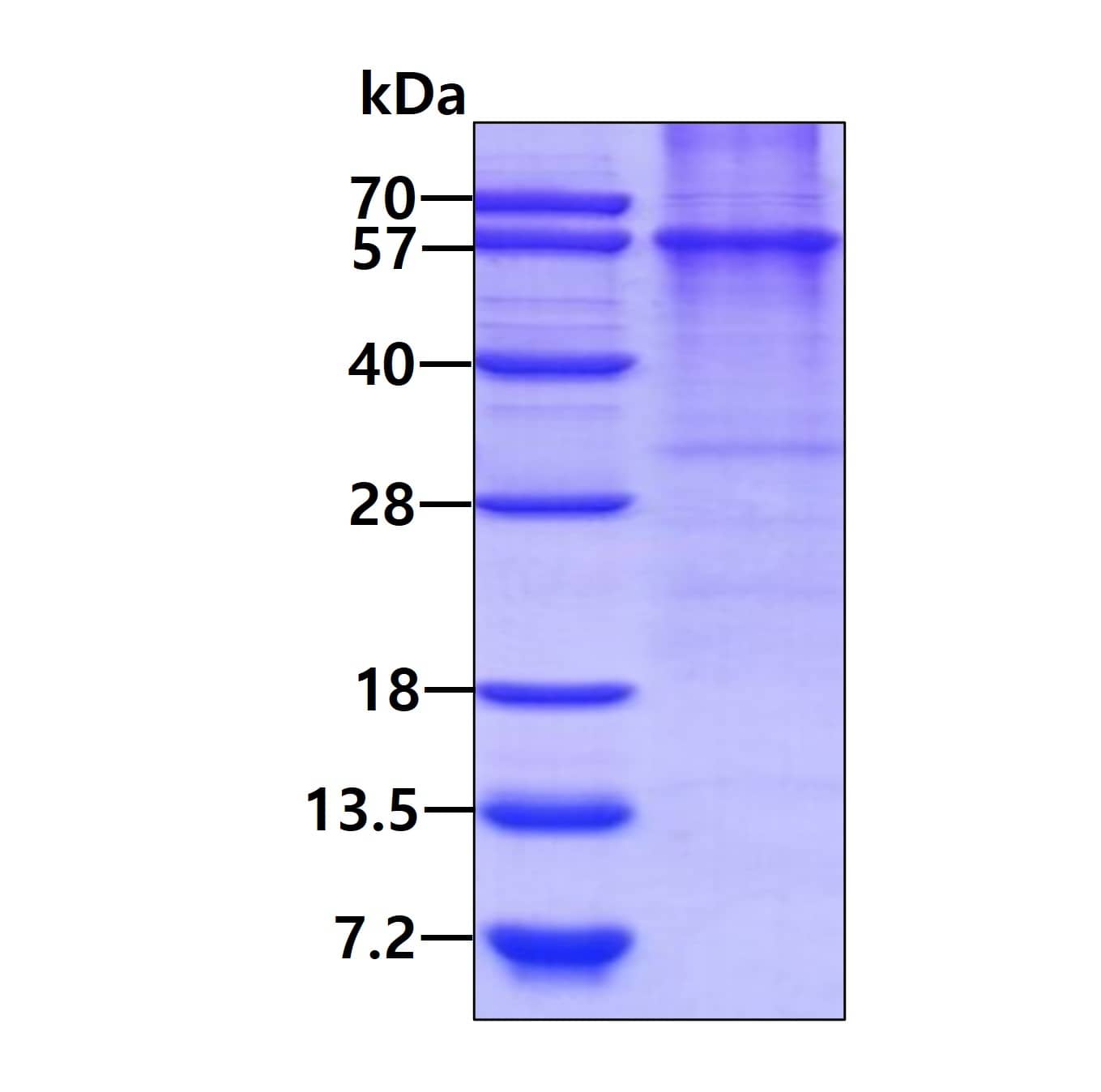 SDS-Page: Recombinant Human Syntaphilin His Protein [NBC1-18350] - 3ug by SDS-PAGE under reducing condition and visualized by coomassie blue stain.