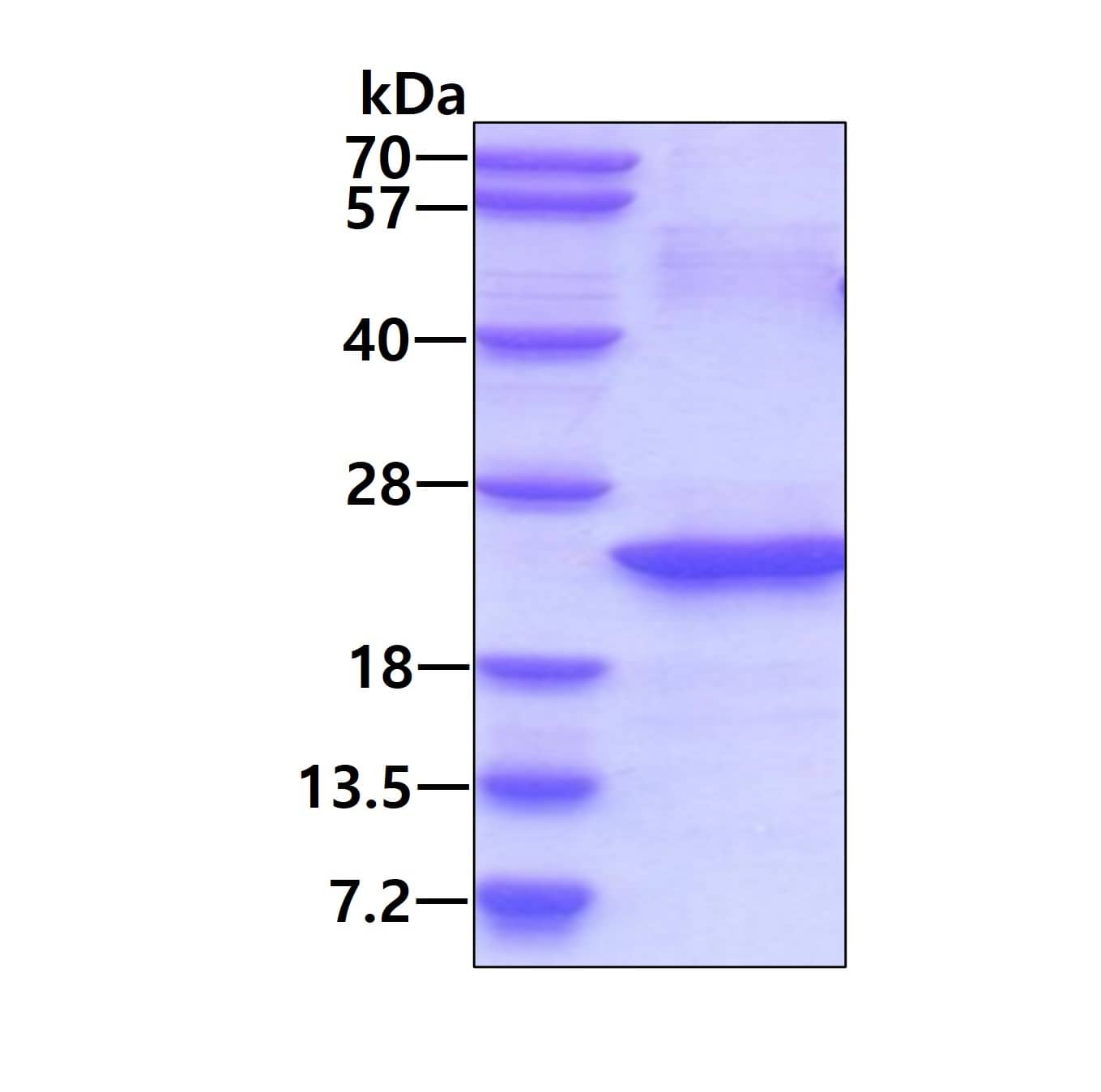 SDS-PAGE Recombinant Human IL-32 His Protein