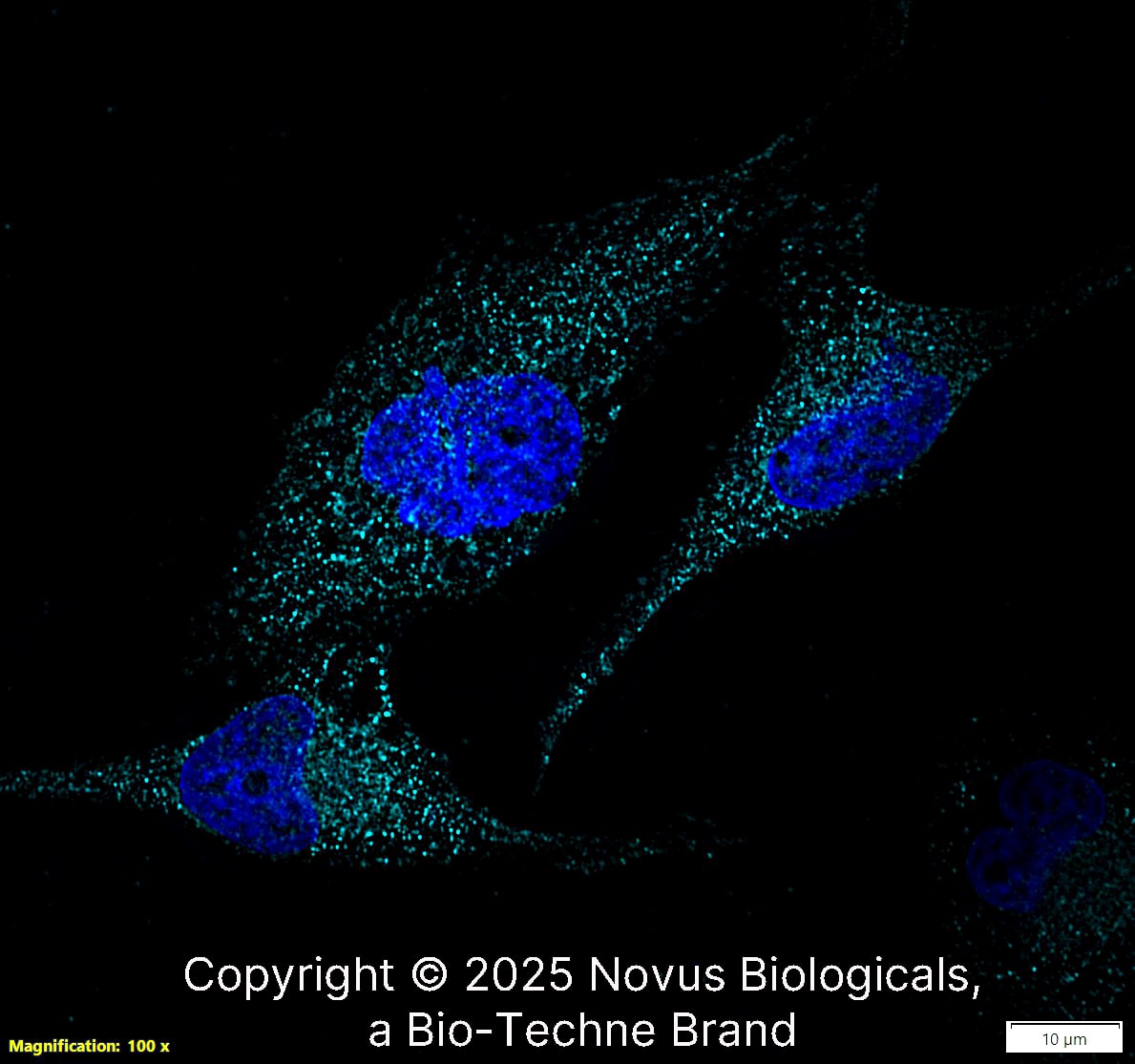 SR-AI/MSR was detected in immersion fixed SJCRH30 human Rhabdomyosarcoma cell line using Rabbit anti-SR-AI/MSR Antigen Affinity Purified Polyclonal Antibody conjugated to Alexa Fluor® 647 (Catalog # NBP1-00092AF647) (light blue) at 10 µg/mL overnight at 4C. Cells were counterstained with DAPI (blue). Cells were imaged using a 100X objective and digitally deconvolved.  