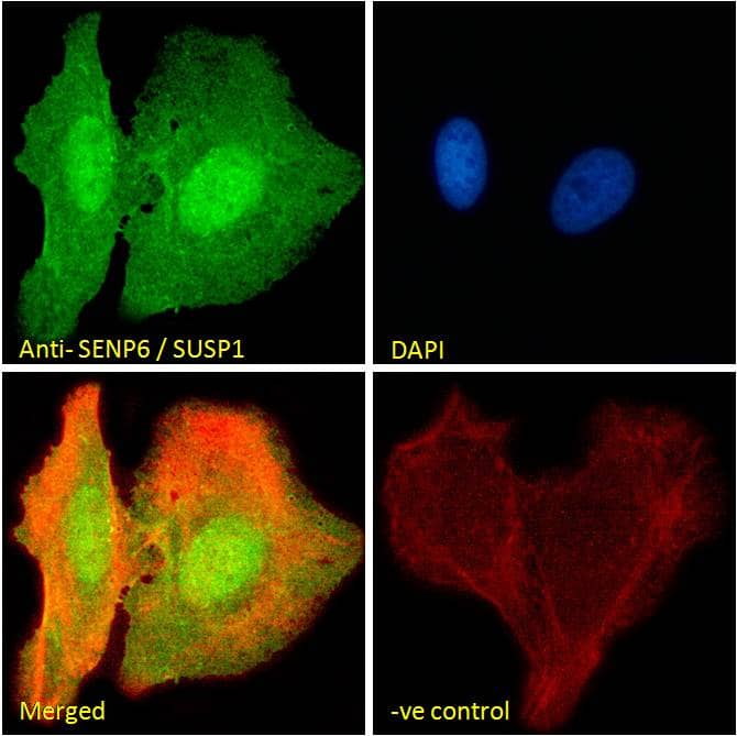 Immunocytochemistry/Immunofluorescence: SENP6 Antibody [NBP1-00238] - Immunofluorescence analysis of paraformaldehyde fixed U2OS cells, permeabilized with 0.15% Triton. Primary incubation 1hr (10ug/ml) followed by Alexa Fluor 488 secondary antibody (2ug/ml), showing nuclear and cytoplasmic staining. Actin filaments were stained with phalloidin (red) and the nuclear stain is DAPI (blue). Negative control: Unimmunized goat IgG (10ug/ml) followed by Alexa Fluor 488 secondary antibody (2ug/ml).