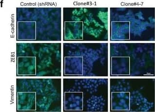 The effect of N-BLR knockdown on invasion by specific siRNAs. a N-BLR abundance is decreased in stably silenced clones. b Invasion assays at 36 h show significant reduction of stably silenced N-BLR invading cells. c Migration assay at 24 h identified also significant reduction in migration of stably silenced N-BLR clones. d The 12 most significantly differentially expressed genes for both upregulated and downregulated genes. The data originated from 44 K Agilent microarray where HCT116 stable shRNA N-BLR clones #3-1 and #4-7 were compared with HCT116 empty vector control clone. The probes recognizing E-cadherin and vimentin are in red and blue, respectively. e Confirmation of microarray data by real time PCR shows that E-cadherin is increased and vimentin is markedly decreased in stably silenced clones (#3-1 and #4-7). f E-cadherin, vimentin, and ZEB1 were identified in vitro by immunofluorescence with specific antibodies. Immunofluorescence signal of E-cadherin (green color) was markedly increased in both clones. The ZEB1 signal was present in cells with empty vector (green color) but not in clones #3-1 and #4-7. Blue color indicate nuclei. Single green, blue, and merged channel images of ZEB1 are reported in Additional file 3: Figure S9B. g ZEB1 mRNA downregulation in HCT116 stable shRNA N-BLR clones #3-1 and #4-7 compared with control HCT116 empty vector clone. h Western blotting for E-cadherin and ZEB1 measured in the same clones; vinculin was used as loading control. (Student’s t-test; *p < 0.05; **p < 0.01; ***p < 0.001; ****p < 0.0001) Image collected and cropped by CiteAb from the following open publication (//pubmed.ncbi.nlm.nih.gov/28535802), licensed under a CC-BY license. Not internally tested by Novus Biologicals.