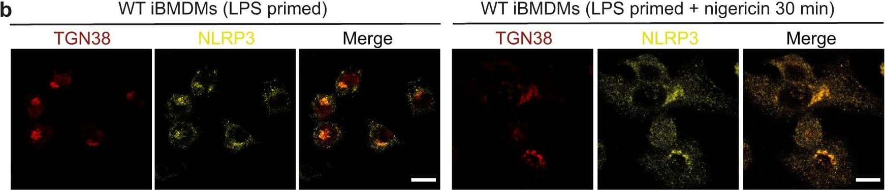 Localization of vesicles with accumulated ceramides in ASC specks by live-cell fluorescence confocal microscopy and cryo-ET.a Distribution of BODIPY TR ceramide (BCer) during ASC speck formation in iBMDMs expressing ASC-mCerulean, or WT iBMDMs stained with FAM-FLICA. Areas of speck formation are boxed. See Supplementary Movie 3 for full time courses. Right, percentage of whole-cell fluorescence that mapped to the area of speck formation, before and after speck formation, t0 and tS (1–3 min and 20–50 min after nigericin addition), respectively. 12 specks from ASC-mCerulean iBMDMs and 11 specks from WT iBMDMs were analyzed. See Source Data File for source data. Scale bars, 10 um. b Immunofluorescence microscopy of LPS-primed WT iBMDMs with or without nigericin stimulation. Anti-NLRP3 partially colocalized with anti-TGN38. The TGN was dispersed following stimulation. Scale bar, 10 um. See Supplementary Movie 4 for a Z-stack series. The images are representative of three independent experiments, with at least 20 cells imaged per experiment. c Immunofluorescence microscopy of LPS-primed ASC-mCerulean iBMDMs with or without nigericin stimulation, and with nigericin stimulation and caspase inhibitor Z-VAD-FMK. There is little overlap between ASC-mCerulean and anti-TGN38 fluorescence. Scale bars, 10 um. The images are representative of three independent experiments, with at least 20 cells imaged per experiment. d 1.36-nm thick virtual tomographic slice within an ASC speck. Scale bar, 200 nm. Lower panel, 3-D segmentation model. e Vesicles from cryo-ET reconstructions of ASC-mCerulean iBMDMs. Scale bar, 100 nm. The histogram shows the vesicle size distribution. Image collected and cropped by CiteAb from the following open publication (//pubmed.ncbi.nlm.nih.gov/37945612), licensed under a CC-BY license. Not internally tested by Novus Biologicals.