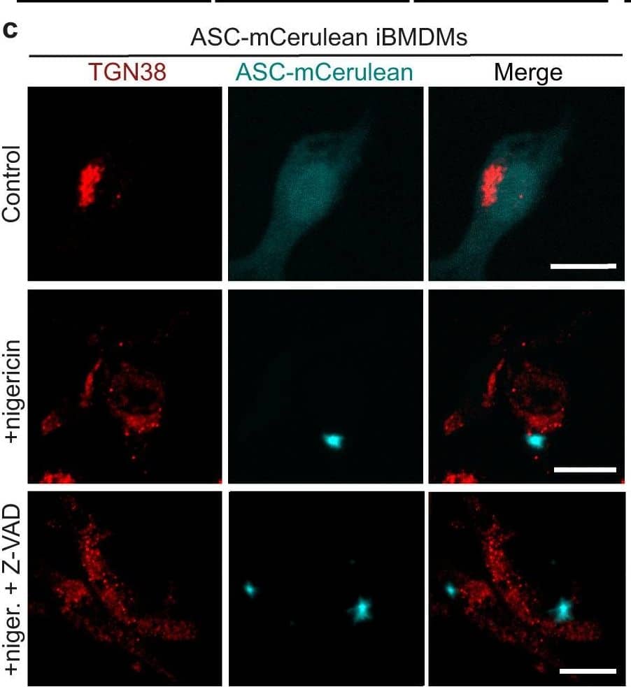 Localization of vesicles with accumulated ceramides in ASC specks by live-cell fluorescence confocal microscopy and cryo-ET.a Distribution of BODIPY TR ceramide (BCer) during ASC speck formation in iBMDMs expressing ASC-mCerulean, or WT iBMDMs stained with FAM-FLICA. Areas of speck formation are boxed. See Supplementary Movie 3 for full time courses. Right, percentage of whole-cell fluorescence that mapped to the area of speck formation, before and after speck formation, t0 and tS (1–3 min and 20–50 min after nigericin addition), respectively. 12 specks from ASC-mCerulean iBMDMs and 11 specks from WT iBMDMs were analyzed. See Source Data File for source data. Scale bars, 10 um. b Immunofluorescence microscopy of LPS-primed WT iBMDMs with or without nigericin stimulation. Anti-NLRP3 partially colocalized with anti-TGN38. The TGN was dispersed following stimulation. Scale bar, 10 um. See Supplementary Movie 4 for a Z-stack series. The images are representative of three independent experiments, with at least 20 cells imaged per experiment. c Immunofluorescence microscopy of LPS-primed ASC-mCerulean iBMDMs with or without nigericin stimulation, and with nigericin stimulation and caspase inhibitor Z-VAD-FMK. There is little overlap between ASC-mCerulean and anti-TGN38 fluorescence. Scale bars, 10 um. The images are representative of three independent experiments, with at least 20 cells imaged per experiment. d 1.36-nm thick virtual tomographic slice within an ASC speck. Scale bar, 200 nm. Lower panel, 3-D segmentation model. e Vesicles from cryo-ET reconstructions of ASC-mCerulean iBMDMs. Scale bar, 100 nm. The histogram shows the vesicle size distribution. Image collected and cropped by CiteAb from the following open publication (//pubmed.ncbi.nlm.nih.gov/37945612), licensed under a CC-BY license. Not internally tested by Novus Biologicals.
