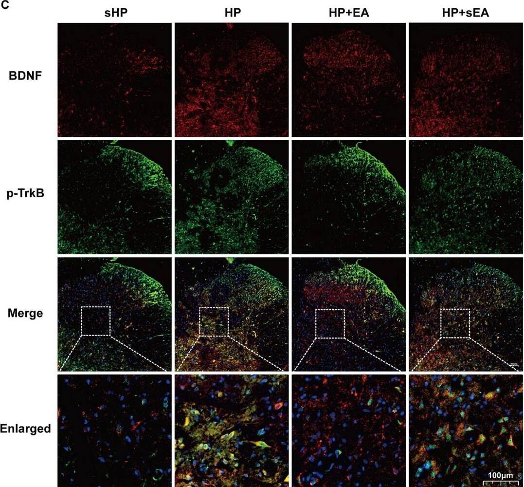 BDNF and TrkB in the L4-L6 SCDH plays a key role in the hyperalgesic priming model. (A-B) The quantification of the Western blots results and a representative Western blot showing BDNF and p-TrkB protein isolated from the ipsilateral SCDH 48 h after 2nd injection. (C) Representative immunofluorescence images of BDNF (red) merged with p-TrkB (green) in ipsilateral L4-6 SCDH of hyperalgesic priming rats. (D-F) The immunofluorescence quantification of BDNF and p-TrkB co-expression cells in ipsilateral L4-6 SCDH. (G-H) Evaluation of BDNF and p-TrkB gene expression in ipsilateral L4-6 SCDH using qPCR in the sHP, HP, HP + EA, HP + sEA groups 48 h after 2nd injection. Data are presented as mean +/- SEM, n = 5; *p < 0.05, **p < 0.01 vs sHP group, #p < 0.05, ##p < 0.01 vs HP group. Two-way ANOVA with Tukey's post-hoc test was applied in. (For interpretation of the references to colour in this figure legend, the reader is referred to the web version of this article.) Image collected and cropped by CiteAb from the following open publication (//pubmed.ncbi.nlm.nih.gov/36875547), licensed under a CC-BY license. Not internally tested by Novus Biologicals.