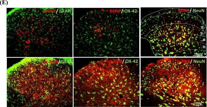 The expression of BDNF-TrkB signaling in the SDH of CYP-induced cystitis. a Changes of the mechanical threshold in CYP-induced cystitis model. Compared to that in the control group, the mechanical threshold of the cystitis group decreased significantly after the CYP injection and remained low until day 17, and the minimum threshold value was reached on day 12. The expression of b BDNF, c TrkB, and dp-TrkB were evaluated by western blots. Compared to the control group, they were upregulated on days 8, 12, and 17. e Immunofluorescence double staining assay of BDNF and p-TrkB in the SDH. BDNF and p-TrkB (red), NeuN, GFAP, and OX-42( green), co-localization (yellow). BDNF was mainly colocalized in neurons which mainly located in Laminate II to IV. And TrkB receptors expressed in neurons, microglia, and astrocytes. The white dotted lines in picture “BDNF/NeuN