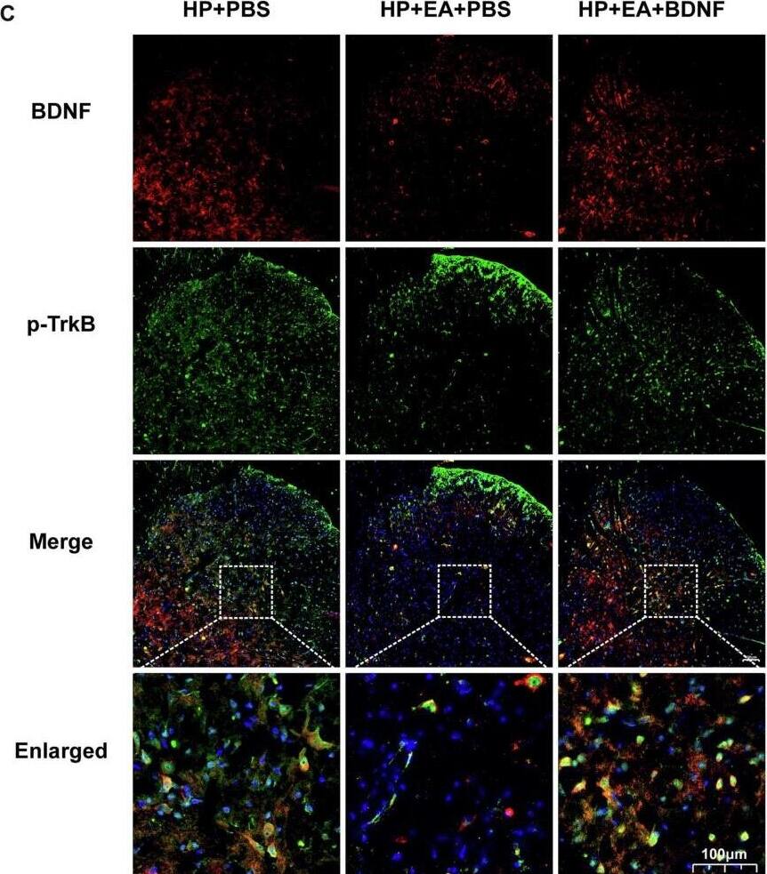 BDNF recombinant protein intervention increased phosphorylation of TrkB. (A-B) The quantification of the Western blots results and a representative Western blot showing BDNF and p-TrkB protein isolated from the ipsilateral SCDH 48 h after 2nd injection. (C) Representative immunofluorescence images of BDNF (red) merged with p-TrkB (green) in ipsilateral L4-6 SCDH of BDNF recombinant protein intervention rats. (D-F) The immunofluorescence quantification of BDNF and p-TrkB co-expression cells in ipsilateral L4-6 SCDH. (G-H) Evaluation of BDNF and p-TrkB gene expression in ipsilateral L4-6 SCDH using qPCR in the HP + PBS, HP + EA + PBS, HP + EA + BDNF groups 48 h after 2nd injection. Data are presented as mean +/- SEM, n = 5; *p < 0.05, **p < 0.01 vs HP + PBS group, #p < 0.05, ##p < 0.01 vs HP + EA + PBS group. Two-way ANOVA with Tukey's post-hoc test was applied in. (For interpretation of the references to colour in this figure legend, the reader is referred to the web version of this article.) Image collected and cropped by CiteAb from the following open publication (//pubmed.ncbi.nlm.nih.gov/36875547), licensed under a CC-BY license. Not internally tested by Novus Biologicals.