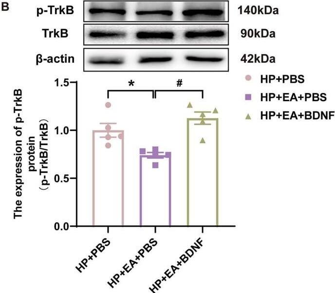BDNF recombinant protein intervention increased phosphorylation of TrkB. (A-B) The quantification of the Western blots results and a representative Western blot showing BDNF and p-TrkB protein isolated from the ipsilateral SCDH 48 h after 2nd injection. (C) Representative immunofluorescence images of BDNF (red) merged with p-TrkB (green) in ipsilateral L4-6 SCDH of BDNF recombinant protein intervention rats. (D-F) The immunofluorescence quantification of BDNF and p-TrkB co-expression cells in ipsilateral L4-6 SCDH. (G-H) Evaluation of BDNF and p-TrkB gene expression in ipsilateral L4-6 SCDH using qPCR in the HP + PBS, HP + EA + PBS, HP + EA + BDNF groups 48 h after 2nd injection. Data are presented as mean +/- SEM, n = 5; *p < 0.05, **p < 0.01 vs HP + PBS group, #p < 0.05, ##p < 0.01 vs HP + EA + PBS group. Two-way ANOVA with Tukey's post-hoc test was applied in. (For interpretation of the references to colour in this figure legend, the reader is referred to the web version of this article.) Image collected and cropped by CiteAb from the following open publication (//pubmed.ncbi.nlm.nih.gov/36875547), licensed under a CC-BY license. Not internally tested by Novus Biologicals.