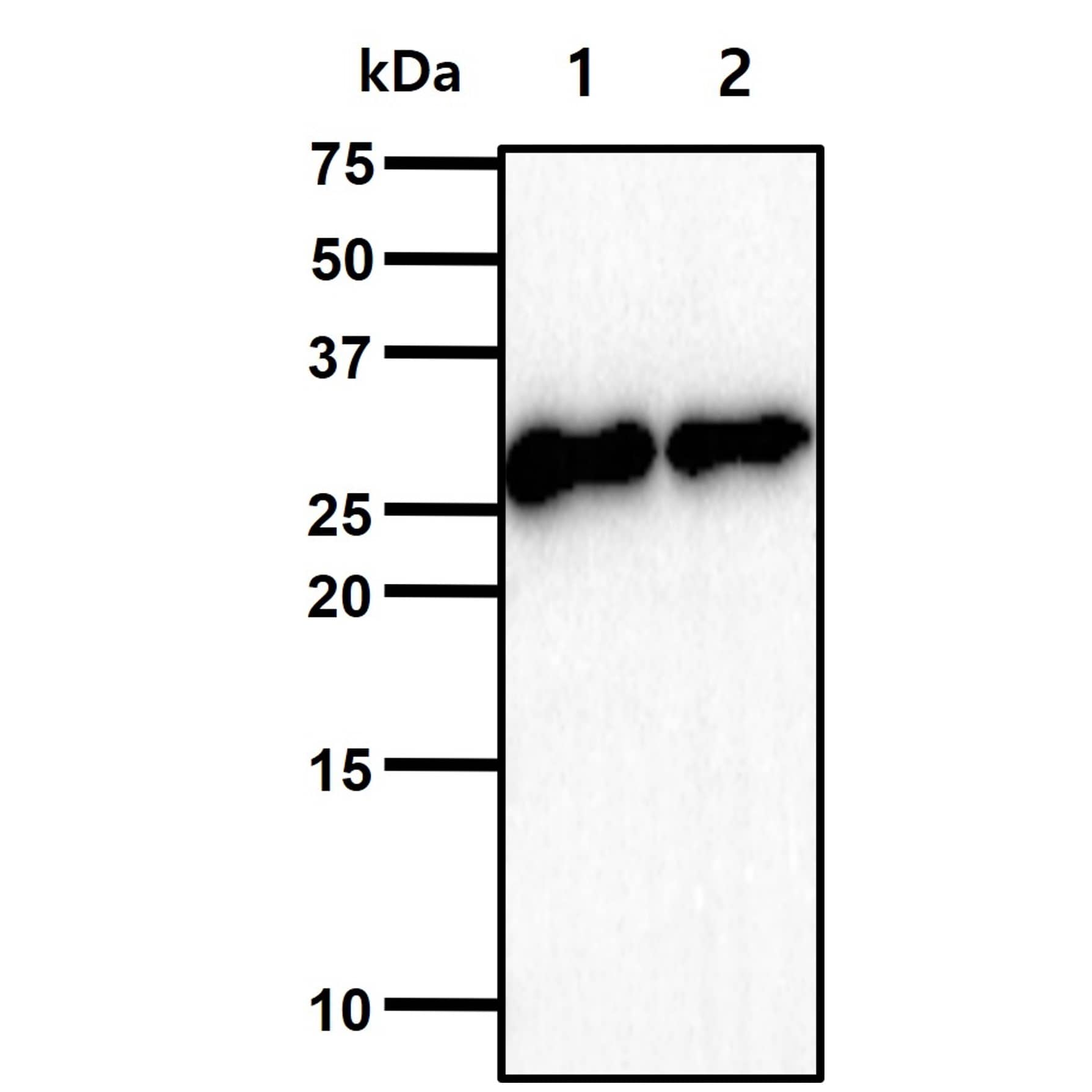 The cell lysates(40ug) were resolved by SDS-PAGE, transferred to PVDF membrane and probed with NBP1-04261 (1:1000). Proteins were visualized using a goat anti-mouse secondary antibody conjugated to HRP and an ECL detection system. Lane 1.: HepG2 cell lysate. Lane 2.: Lncap cell lysate