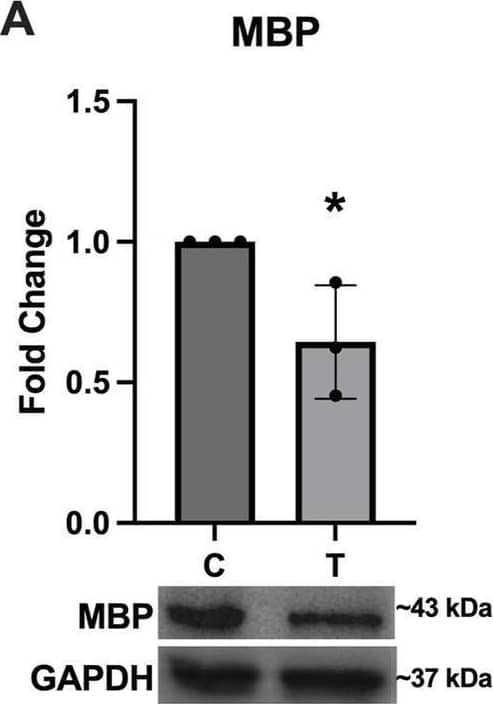 Myelination protein expression is downregulated in response to ER stress. The myelination proteins (A) MBP [t (4) = 3.056, p = 0.0378], (B) PLP [t (4) = 29.84, p < 0.0001], and (C) CNPase [t (4) = 4.797, p = 0.0093] were all significantly downregulated after 24-hour exposure to 10 μg/mL tunicamycin compared to control cells. *p < 0.05; **p < 0.01; ****p < 0.0001. Image collected and cropped by CiteAb from the following open publication (//pubmed.ncbi.nlm.nih.gov/39411401), licensed under a CC-BY license. Not internally tested by Novus Biologicals.