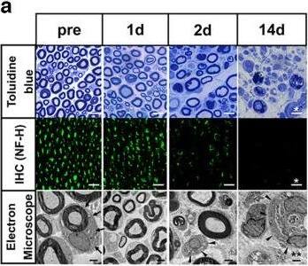 Wallerian degeneration and mitochondrial degeneration in axon for rat’s distal nerve stump. a, Representative images of toluidine blue staining, immunohistochemistry (NF-H), electron microscopy, before (pre) and 1, 2, and 14 d after axotomy. Immunohistochemistry was obtained the same results for three individuals. Scale bar, * 10 μm, ** 2 μm. Arrows, myelinated axon; arrowheads, demyelinated Schwann cell. b, Quantification of the myelinated axon. c, d, Quantification of the G-ratio [c: cumulative G-ratio per individual, d: scatter plot, Spearman’s rank correlation coefficient and p values showing G-ratio of individual myelinated axons against axon diameter (n = 400)]. The histologic WD was observed significantly from 2 d after axotomy. In axons, before (pre) and 1 and 2 d after axotomy were evaluated, except for after 14 d with completely collapsed axon morphology (n = 4 rat per group). e, Representative images of mitochondrial findings, before (pre) and 1, 2, and 14 d after axotomy. Evaluation was performed in axons and Schwann cells separately. Scale bar, * 200 nm. f, Violin plot of mitochondrial diameter (nm; n = 200). Cumulative mitochondria diameter per individual are also shown (n = 4 rat per group). g, Quantitative analysis of atypical mitochondria (%; n = 4 rat per group). In axons, mitochondria were significantly degenerated from 1 d after axotomy, whereas in Schwann cells, mitochondria were not significantly degenerated until 14 d after axotomy. All histologic evaluations were performed 3 mm distal to the sectional end and corresponding uninjured nerve. Error bars indicate SD; *p < 0.05, ***p < 0.001, one-way ANOVA followed by the Tukey’s post hoc test (for comparison of axons and Schwann cells, respectively). Image collected and cropped by CiteAb from the following open publication (//pubmed.ncbi.nlm.nih.gov/36894321), licensed under a CC-BY license. Not internally tested by Novus Biologicals.