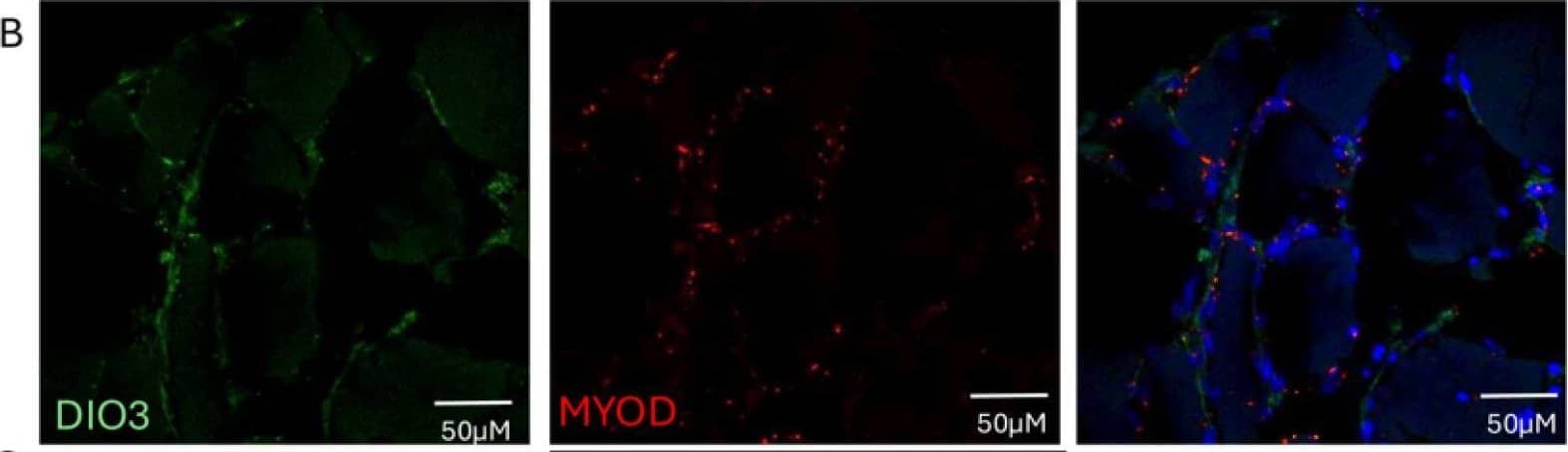 Type 3 deiodinase expression and colocalization on muscle. (A) DIO3 expression is augmented in the muscle of the critically ill, specifically in those with NTIS. (B) panel. RNAscope showing the colocalization of DIO3 and MYOD+, augmented in patients with T3 levels < 35 ng/dL. (C) RNAscope showing that DIO3 and PAX7+ do not colocalize in patients with T3 levels < 35 ng/dL. (D) RNAscope of DIO3 and DIO2, also shows that these genes do not colocalize in patients with T3 levels < 35 ng/dL. DAPI (blue), DIO3 (green), MYOD, PAX7, DIO2. (red) * p = 0.001, ** p < 0.0001. ns: Statistically not significant. Image collected and cropped by CiteAb from the following open publication (//pubmed.ncbi.nlm.nih.gov/40141055), licensed under a CC-BY license. Not internally tested by Novus Biologicals.
