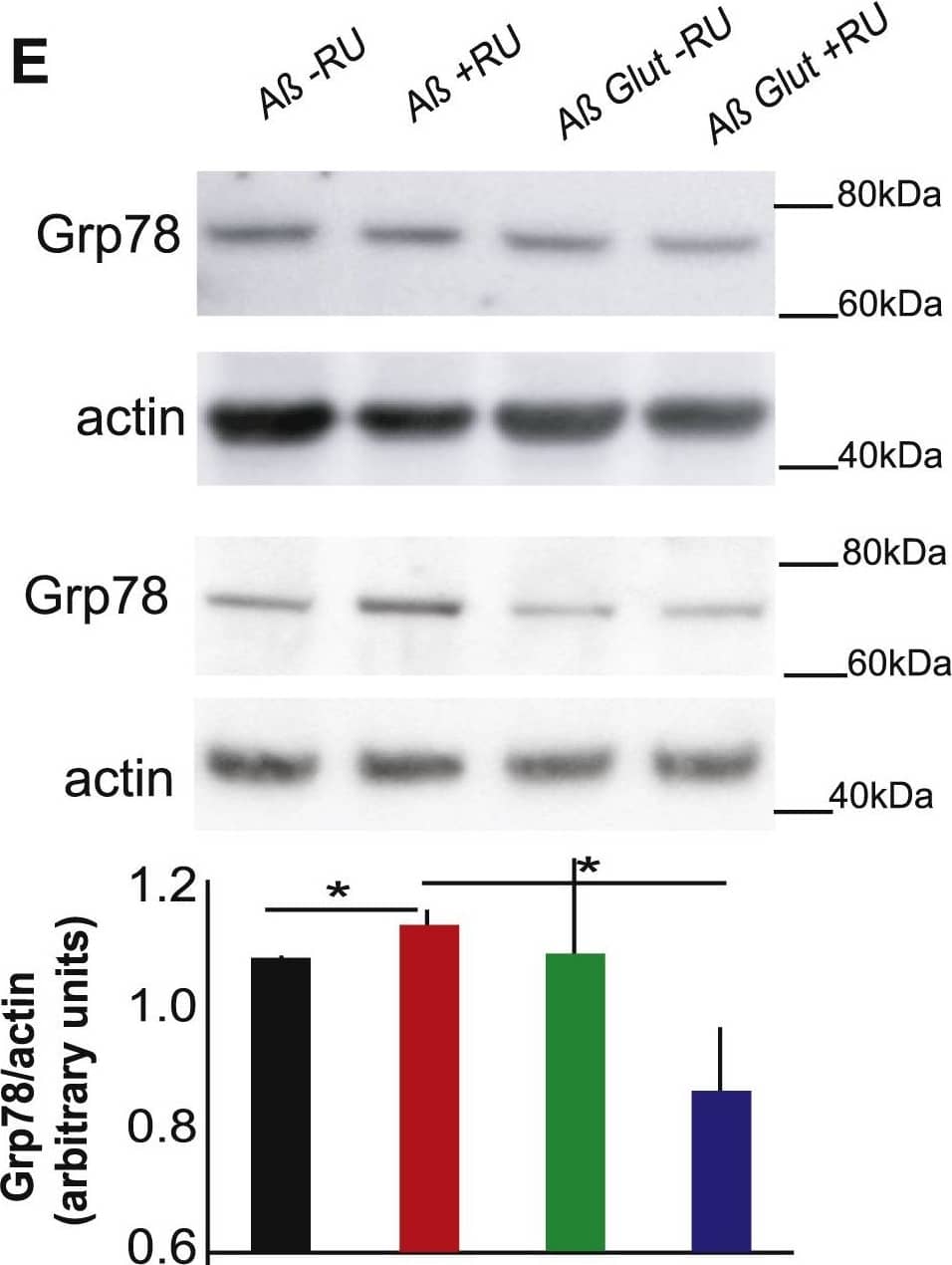 Western Blot: GRP78/HSPA5 Antibody - BSA Free [NBP1-06274] - UPR Components Activated in A beta -Expressing Flies Are Induced Even Further by Glut1 Overexpression(A) Western blot of eIF2 phosphorylation levels in heads of A beta - & A beta Glut1-expressing flies (+RU) & in controls (-RU), showing no significant difference. Bottom: plotted as means ± SEM (n = 3). Top: a representative gel from the same samples.(B) Grp78 mRNA levels in heads of 18-day-old flies expressing A beta  or A beta  Glut1 in neurons (+RU) & uninduced controls (-RU), measured by qPCR (relative to eIF1A), plotted as means ± SEM. Genotypes: UAS A beta ; elavGS, UAS A beta /UAS Glut1; elavGS.(C) Quantification of GFP fluorescence in fly brains expressing an Xbp1GFP splicing reporter, plotted as means ± SEM (n = 6–13). Genotypes: elavGS/UAS-Xbp1GFP, UAS A beta ; elavGS/UAS-Xbp1GFP, UAS A beta /UAS Glut1; elavGS/UAS-Xbp1GFP.(D) Spliced Xbp1 mRNA levels in heads of 18-day-old flies expressing A beta  or A beta  Glut1 in neurons (+RU) & uninduced controls (-RU), measured by qPCR (relative to eIF1A), plotted as means ± SEM(E) Western blot of Grp78 in 14-day-old flies of the same genotypes, plotted below as means ± SEM (n = 6–16). The image is a representative gel of the same samples. Genotypes: UAS A beta ; elavGS, UAS A beta /UAS Glut1; elavGS.∗p ≤ 0.05; ∗∗p ≤ 0.01, by ANOVA. See also Figure S2. Image collected & cropped by CiteAb from the following publication (//pubmed.ncbi.nlm.nih.gov/27524482), licensed under a CC-BY license. Not internally tested by Novus Biologicals.