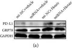 Western Blot: GRP78/HSPA5 Antibody - BSA Free [NBP1-06274] - Hotair promotes the expression of GRP78 & PD-L1, mediates the proliferation, & helps to regulate the T cell-mediated immune responses in Tu212 & Hep-2 cells. Western blot analysis of GRP78 & PD-L1 after mi-NC or has-miR-30a-5p & vehicle or Hotair transfection in Hep-2 cells (a). The relative expression level of GRP78 & PD-L1 in Hep-2 cells (b). (c–e) The cell viability, apoptosis, & colony formation after mi-NC or has-miR-30a-5p & vehicle or Hotair transfection in Hep-2 cells. (f–h) T cell killing assay of target Tu212 & Hep-2 cells cocultured with PBMC, & ELISA detects the concentration of cytokines (g) IFN-gamma  & (h) IL-2. The targeted Tu212 & Hep-2 cells after 24 h transfected with mi-NC or has-miR-30a-5p & vehicle or Hotair were cocultured with PBMC, & the cytotoxicity was measured by the LDH release assay. Data are mean ± SD of at least three independent experiments; ∗p < 0.05; ∗∗p < 0.01; ∗∗∗p < 0.001. Image collected & cropped by CiteAb from the following publication (//pubmed.ncbi.nlm.nih.gov/35419461), licensed under a CC-BY license. Not internally tested by Novus Biologicals.