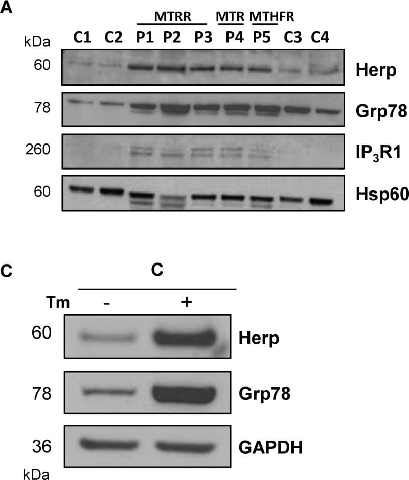 Western Blot: GRP78/HSPA5 Antibody - BSA Free [NBP1-06274] - Analysis of protein levels involved in ER stress & Ca2+ homeostasis & processing of mRNA XBP1 in control & patients-derived fibroblasts.(A) Equal amounts from controls & patients were loaded (50 μg of total cell lysates) & subjected to Western Blot with anti-Herp, anti-Grp78 & anti-IP3R1 antibodies. We used anti-Hsp60 antibody to ensure equal amounts of protein loaded in each lane. This result is representative of three independent experiments. Protein quantification was performed by laser densitometry. The ratios between proteins/Hsp60 for each cell line were calculated to determine the expression fold-change relative to control. (B) Data represent mean ± standard deviation of three independent experiments. (C) Equal amounts from controls were loaded (50 μg of total cell lysates) & subjected to Western Blot with anti-Herp & anti-Grp78 antibodies. We used anti-GAPDH antibody to ensure equal amounts of protein loaded in each lane. This result is representative of two independent experiments. (D) Equal amounts from control & patients were loaded (50 μg of total cell lysates) & subjected to Western Blot with anti-phospho-PERK antibody. We used anti-GAPDH antibody to ensure equal amounts of protein loaded in each lane. This result is representative of two independent experiments. (E) RT-PCR analysis of the processing of mRNA XBP1 transcription factor. Tm: tunicamycin; u: XBP1 unspliced form; s: XBP1 spliced form. Image collected & cropped by CiteAb from the following publication (//dx.plos.org/10.1371/journal.pone.0150357), licensed under a CC-BY license. Not internally tested by Novus Biologicals.