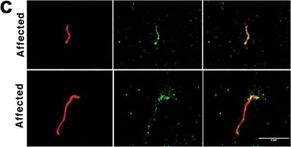 Immunocytochemistry/ Immunofluorescence: Meckelin Antibody [NBP1-06590] - Meckelin expression in unaffected & affected lamb kidney epithelial cells & primary cilia. (a, left) Immunoblot showing expression of meckelin (~100 KDa) in cultured epithelial cells from an unaffected lamb kidney, & an affected lamb kidney.  beta -actin indicates equivalent protein loading in each lane. (a, right) Quantification of the meckelin band in the immunoblot, normalised to the loading control, shows no significant difference in relative protein expression. (b) Confocal maximum projection of acetylated  alpha -tubulin (red) & meckelin (green) labelling in sections from unaffected & affected kidneys. In unaffected kidneys, meckelin was present within the cytoplasm of the epithelial cells & strongly localised to the base of the cilium. In contrast, meckelin was distributed along the length of the ciliary axonemes of affected cyst-lining cells. Meckelin distribution within the cytoplasm of cyst lining cells was similar to observations in unaffected epithelia (c) Acetylated  alpha -tubulin (red) & meckelin (green) labelling on putative ciliary fragments located in the cyst lumen of affected kidneys (yellow indicates co-localisation in the merged image). Numerous smaller particles contained in the cyst luminal contents were also labeled with meckelin, but were not labeled with acetylated  alpha -tubulin. Scale bars = 5 μm. Image collected & cropped by CiteAb from the following publication (//pubmed.ncbi.nlm.nih.gov/28487520), licensed under a CC-BY license. Not internally tested by Novus Biologicals.