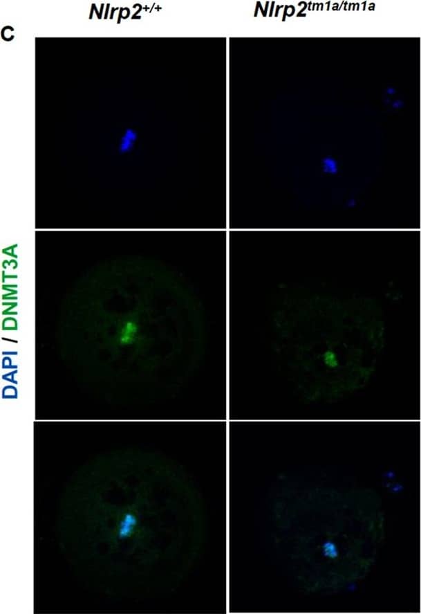 DNMT1 reveals a SCMC-like cortical localization with aberrant localization in Nlrp2tm1a/tm1a derived oocytes.(A) Whole mount immunofluorescence co-staining with anti-DNMT1 and DAPI on the same Nlrp2M+/Z+ embryos used to stain NLRP2 reveals a SCMC-like cortical localization of DNMT1 with a diffuse nuclear stain in later stage embryos. Scale bar represented is 200 μm. (B) DNMT1 staining in paraffin embedded oocyte sections reveals a less cortical, more cytoplasmic intense stain with nucleolar focus in oocytes from Nlrp2tm1a/tm1a dams compared to oocytes from Nlrp2+/+ dams. (C) Whole mount immunofluorescence for DNMT3A in unfertilized control oocytes reveals a characteristic metaphase associated localization and no difference is noted in oocytes derived from Nlrp2tm1a/tm1adams. (D) Whole mount immunofluorescence in unfertilized oocytes reveals that as expected, DNMT3B is not yet expressed in unfertilized control oocytes and no expression is noted in oocytes derived from Nlrp2tm1a/tm1adams. Image collected and cropped by CiteAb from the following open publication (//pubmed.ncbi.nlm.nih.gov/28317850), licensed under a CC-BY license. Not internally tested by Novus Biologicals.