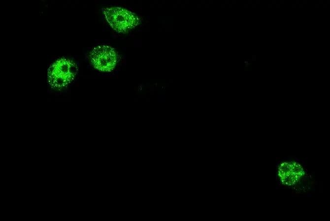 Immunocytochemistry/Immunofluorescence: Rat Monoclonal DYKDDDDK Epitope Tag Antibody (L5) [DyLight 488] [NBP1-06712G] - Normal mouse prostate cells overexpressed with Flag-tagged construct (Green: Flag). Image from verified customer review.