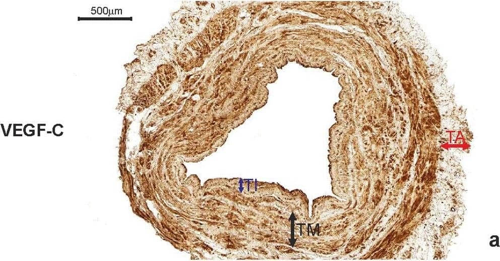 Immunohistochemistry: VEGF-C Antibody (107/F10) - Azide and BSA Free [NBP1-18626] - Internal thoracic artery wall harvested from a patient diagnosed with double-vessel CAD showing immunohistochemical staining. Immunohistochemical staining of VEGF-C (a), CAV2 (b) & CAV3 (c) in an internal thoracic artery obtained from a 67-year-old patient who developed the early graft restenosis within 7 months after coronary artery bypass grafting. VEGF-C is expressed in smooth muscle cells of the tunica media (TM) & endothelial cells present in the tunica intima (TI). CAV2 is present exclusively in smooth muscle cells. Strong expression of CAV3 is observed in smooth muscle cells & in endothelial cells. d Negative control. TA tunica adventitia Image collected & cropped by CiteAb from the following publication (//link.springer.com/10.1007/s00380-018-1158-9), licensed under a CC-BY license. Not internally tested by Novus Biologicals.