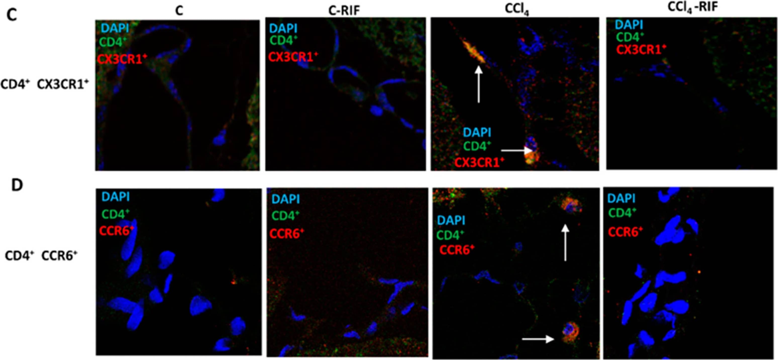 Immunocytochemistry/ Immunofluorescence: CD4 Antibody - BSA Free [NBP1-19371] - Rats with mild liver damage show immune cells infiltration in cerebellum at 4 weeks, which is prevented by rifaximin. Analysis of immune cells infiltration in cerebellum was performed at 4 weeks by immunohistochemistry using antibodies against (A) CD4, a marker of T lymphocytes (F(3,8) = 4.511, p < 0.01) & (B) IBA1, a marker of meningeal & perivascular macrophages (K-W(4,10) = 27.76, p < 0.0001). (C) Double immunofluorescence with anti-CD4 & anti-CX3CR1 as markers of autoreactive CD4+CD28− T lymphocytes was performed & quantified (K-W(4,5) = 8.711, p < 0.05). (D) Double immunofluorescence with anti-CD4 & anti-CCR6 as marker of Th17 lymphocytes was performed & quantified (K-W(4,7) = 8.858, p < 0.05). Number of animals in each group was added under group names. One-way ANOVA with Tukey’s test (CD4+) & nonparametric Kruskal–Wallis (K-W statistic) with Dunn’s test (Iba1, CD4+/CX3CR1+ & CD4+/CCR6+) was performed to compare all groups. Values significantly different from control rats are indicated by asterisks & from CCl4 rats by a. * p < 0.05, a p < 0.05. Image collected & cropped by CiteAb from the following publication (//pubmed.ncbi.nlm.nih.gov/34440206), licensed under a CC-BY license. Not internally tested by Novus Biologicals.