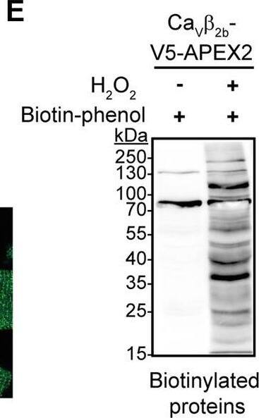 APEX2-mediated proximity biotinylation for the identification of proteins in the Cav beta 2b nanoenvironments in cardiomyocytes. (A) Schematic representation of the APEX2-mediated proximity biotinylation workflow. ARCs were transduced with the construct Cav beta 2b-V5-APEX2 using an adenoviral vector. APEX2 fused to Cav beta 2b enables the biotin labeling of proteins located within a 20-nm radius of Cav beta 2b when the substrates biotin-phenol and H2O2 are present. Biotinylated proteins are further enriched by streptavidin-coated beads through affinity purification and bound proteins are analyzed by mass spectrometry. (B) RT-PCR analysis of the expression pattern of the five Cav beta 2 splice variants (Cav beta 2a-Cav beta 2e) in ARCs. GAPDH was used as control. (C) Western blot analyses to validate the specificity of the anti-Cav beta 2b antibody using lysates from HEK-293 cells overexpressing the different Cav beta 2 splice variants. A commercial anti-Cav beta 2 and an anti-GAPDH antibodies were used as expression and loading controls, respectively. (D) Western blot analysis of Cav beta 2b-V5-APEX2 expression in ARCs (i) and confocal fluorescence images of ARCs expressing or not Cav beta 2b-V5-APEX2 and visualized using anti-Cav beta 2b and anti-V5 antibodies to recognize the endogenous and the recombinant Cav beta 2b proteins, respectively (ii). Scale bar represents 15 μm. (E) Streptavidin blot analysis of endogenous proteins biotinylated by Cav beta 2b-V5-APEX2 in ARCs. (F) Biotinylation of Cav1.2 by Cav beta 2b-V5-APEX2. Western blot analysis using an anti-Cav1.2 antibody after streptavidin-mediated enrichment of biotinylated proteins. All the data shown are representative of three independent experiments. APEX2, ascorbate peroxidase; ARCs, adult rat cardiomyocytes; RyR2, ryanodine receptor 2; bp, base pairs. Image collected and cropped by CiteAb from the following open publication (//pubmed.ncbi.nlm.nih.gov/35047492), licensed under a CC-BY license. Not internally tested by Novus Biologicals.
