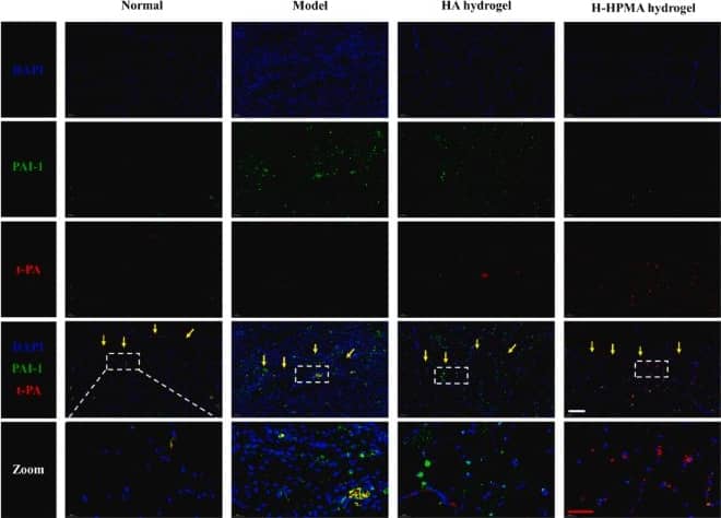 Immunocytochemistry/ Immunofluorescence Serpin E1/PAI-1 Antibody - BSA Free