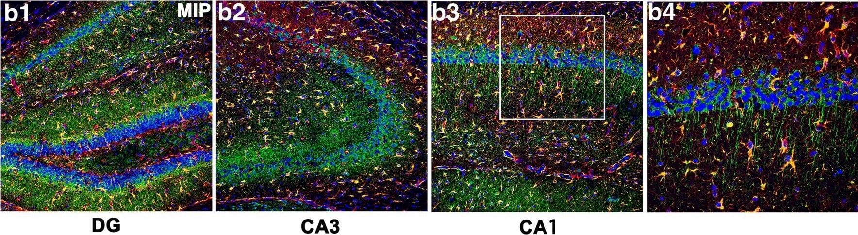 Hippocampal GLT-1 and NR1 expression 3 days after SE with MyD88 inhibition. Sections from the hippocampi of mice in the CP group (A1–A3) and MIP group (B1–B3) 3 days after SE with GLT-1 immunoreactivity in astrocytes and neuronal processes. (A4, B4) Higher magnification of the boxes in (A3) and (B3). (C) Comparison of the numbers of GFAP/GLT-1 double-labeled cells in the DG, CA1, and CA3 between the CP and MIP groups (means +/- SEM, n = 3). *p < 0.05 versus the CP group; **p < 0.01 versus the CP group. Independent samples t tests were performed. (D1) Immunoblots of NR1, NR2a, and NR2b for the control, CP, and MIP groups. (D2–D4) Comparison of NR1, NR2a, and NR2b levels among the above groups (calibrated to  beta -actin). *p < 0.05; ***p < 0.001 between groups. One-way ANOVA followed by Tukey’s test. Scale bars: (A1–A3, B1–B3) 100 μm; (A4, B4) 50 μm Image collected and cropped by CiteAb from the following open publication (//pubmed.ncbi.nlm.nih.gov/30112701), licensed under a CC-BY license. Not internally tested by Novus Biologicals.
