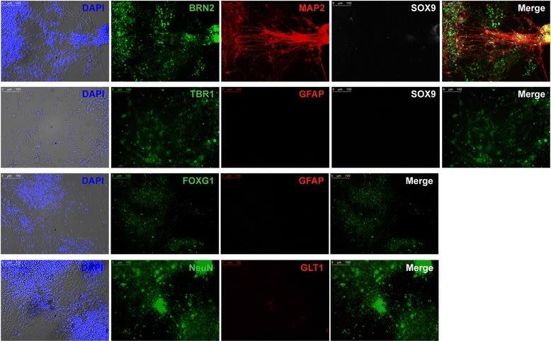 Human NPCs differentiate into mature neurons. Immunofluorescence staining of differentiated neurons derived from human dorsal NPCs (1323–2 line, day 35 after differentiation) for mature cortical neuronal markers expressed in the nucleus (BRN2, TBR1, NeuN) and cytoplasm (MAP2), glial markers (SOX9, GFAP, GLT1), and dorsal forebrain marker (FOXG1). Nuclei stained with DAPI, shown as an overlay over brightfield images. The merge is an overlay of the neuronal and glial markers. Scale bar 100 μm. DAPI 4,6′-diamino-2-phenylindole Image collected and cropped by CiteAb from the following open publication (//pubmed.ncbi.nlm.nih.gov/29544541), licensed under a CC-BY license. Not internally tested by Novus Biologicals.