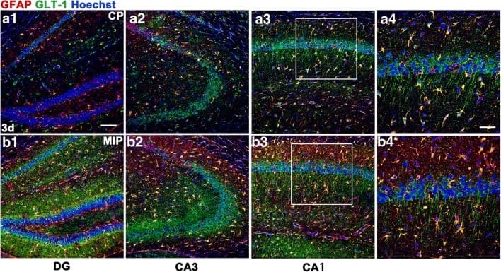 Hippocampal GLT-1 and NR1 expression 3 days after SE with MyD88 inhibition. Sections from the hippocampi of mice in the CP group (A1–A3) and MIP group (B1–B3) 3 days after SE with GLT-1 immunoreactivity in astrocytes and neuronal processes. (A4, B4) Higher magnification of the boxes in (A3) and (B3). (C) Comparison of the numbers of GFAP/GLT-1 double-labeled cells in the DG, CA1, and CA3 between the CP and MIP groups (means +/- SEM, n = 3). *p < 0.05 versus the CP group; **p < 0.01 versus the CP group. Independent samples t tests were performed. (D1) Immunoblots of NR1, NR2a, and NR2b for the control, CP, and MIP groups. (D2–D4) Comparison of NR1, NR2a, and NR2b levels among the above groups (calibrated to  beta -actin). *p < 0.05; ***p < 0.001 between groups. One-way ANOVA followed by Tukey’s test. Scale bars: (A1–A3, B1–B3) 100 μm; (A4, B4) 50 μm Image collected and cropped by CiteAb from the following open publication (//pubmed.ncbi.nlm.nih.gov/30112701), licensed under a CC-BY license. Not internally tested by Novus Biologicals.