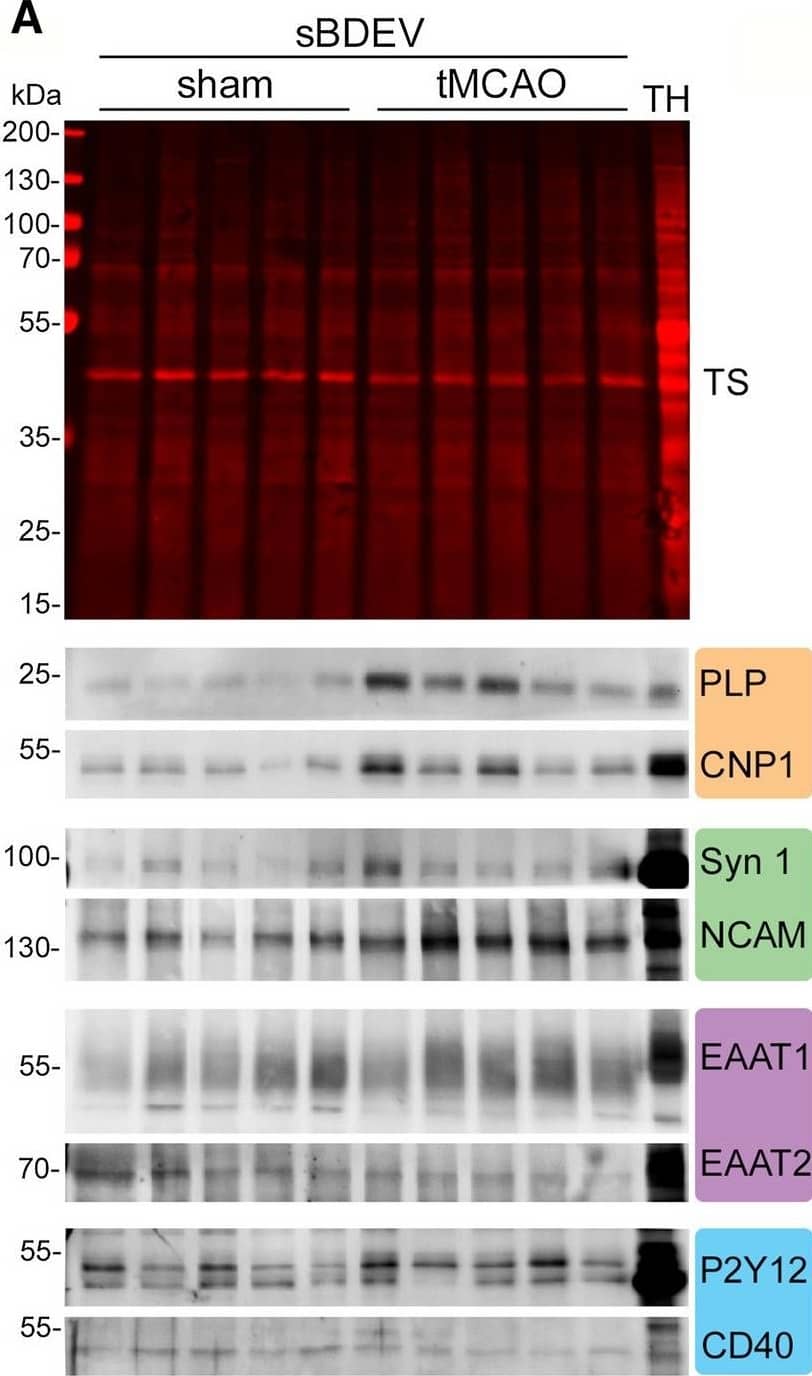 The contribution of oligodendrocytes to the BDEVs pool is significantly upregulated at 72 h after tMCAO. A Western blots of sBDEVs samples from tMCAO and shams (n = 5 per group) blotted for cell-type-specific markers: PLP and CNP1 are used as protein markers for oligodendrocytes (orange frame); synapsin 1 (Syn1) and NCAM as markers for neurons (green); EAAT1 and EAAT2 as protein markers for astrocytes (pink) and P2Y12 and CD40 as markers for microglia/macrophages (blue). TH is a total mouse brain homogenate loaded in parallel for comparison purposes. TS is a representative total protein staining of the nitrocellulose membranes (TSs of all blots used for these analyses are provided in Suppl. Fig. 5). B Dot plots showing the quantifications of the western blot intensities. For the quantification, each band intensity was first referred to the corresponding lanes of the total protein staining. Both markers for oligodendrocytes were found significantly increased upon stroke. Regarding neuronal markers, NCAM was significantly increased while Syn1 only showed a tendency to be elevated. Exact p-values are given in the main text Image collected and cropped by CiteAb from the following open publication (//pubmed.ncbi.nlm.nih.gov/35639208), licensed under a CC-BY license. Not internally tested by Novus Biologicals.