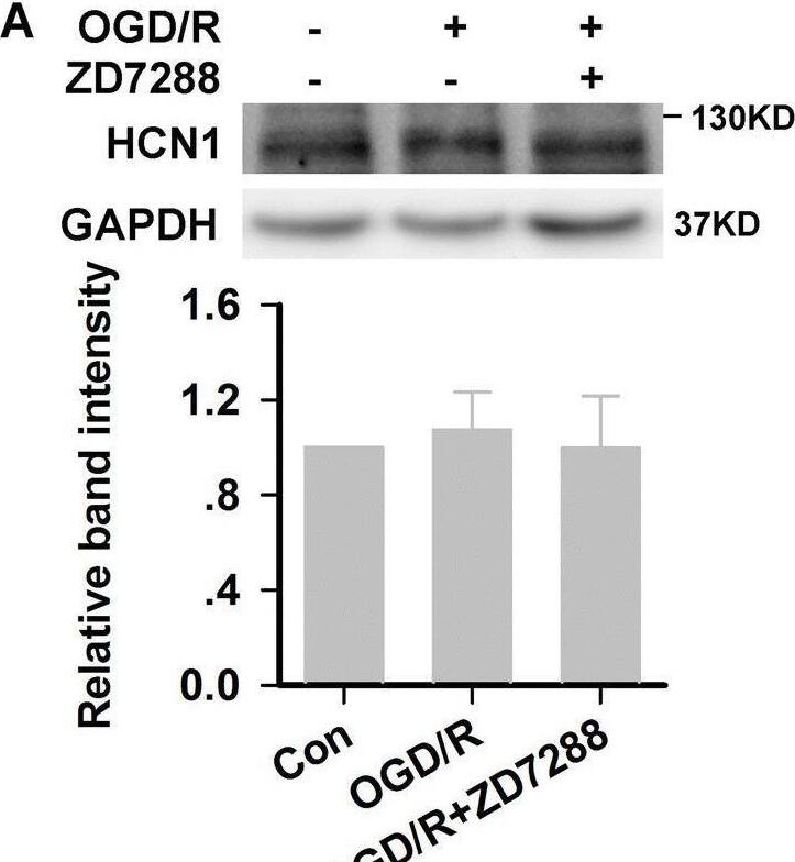 HCN2 subunit knockdown in HT22 neurons. A HCN1 and HCN2 expression in HT22 neurons after OGD/R injury (experiments were performed at least four times with similar results). B Representative photomicrographs of fluorescence produced by EGFP and immunohistochemical staining with anti-HCN2 antibody in HT22 neurons (× 200, scale bar, 200 μm). C Quantitative analysis of HCN2 immunoreactivity (experiments were performed at least three times with similar results). D Relative expression of HCN1 and HCN2 channels at the protein level in Con-shRNA and HCN2-shRNA cells (experiments were performed at least four times with similar results) **P < 0.01 versus control group; ##P < 0.01 versus Con-shRNA group. Image collected and cropped by CiteAb from the following open publication (//pubmed.ncbi.nlm.nih.gov/32519067), licensed under a CC-BY license. Not internally tested by Novus Biologicals.