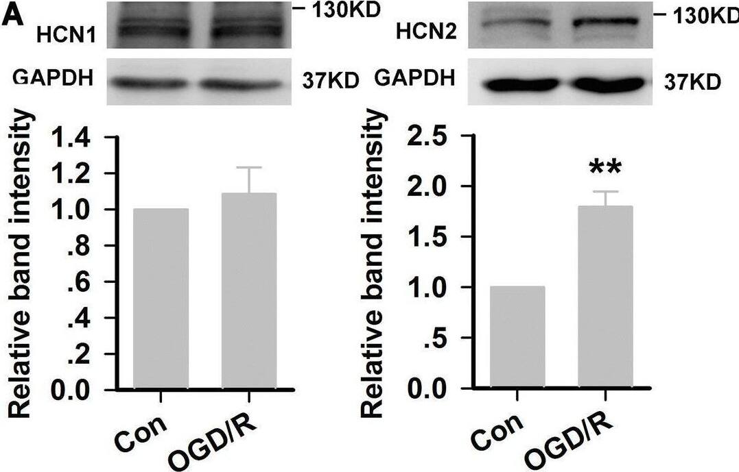 HCN2 subunit knockdown in rat hippocampal CA1 region. A HCN1 and HCN2 expression in CA1 after TGCI (experiments were performed at least four times with similar results). B Distribution of lentivirus in the dorsal hippocampal CA1 region (green; × 40, × 100, scale bars, 100 μm). C Relative expression of HCN1 and HCN2 channels at the protein level in Con-shRNA and HCN2-shRNA rats (experiments were performed at least four times with similar results). **P < 0.01 versus Con group; ##P < 0.01 versus Con-shRNA group. Image collected and cropped by CiteAb from the following open publication (//pubmed.ncbi.nlm.nih.gov/32519067), licensed under a CC-BY license. Not internally tested by Novus Biologicals.